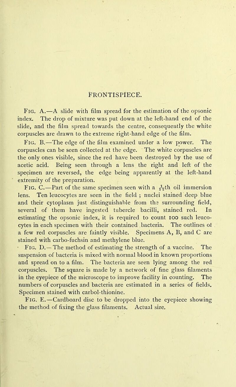 FRONTISPIECE. Fig. A.—A slide with film spread for the estimation of the opsonic index. The drop of mixture was put down at the left-hand end of the slide, and the film spread towards the centre, consequently the white corpuscles are drawn to the extreme right-hand edge of the film. Fig. B.—The edge of the film examined under a low power. The corpuscles can be seen collected at the edge. The white corpuscles are the only ones visible, since the red have been destroyed by the use of acetic acid. Being seen through a lens the right and left of the specimen are reversed, the edge being apparently at the left-hand extremity of the preparation. Fig. C.—Part of the same specimen seen with a rVth oil immersion lens. Ten leucocytes are seen in the field ; nuclei stained deep blue and their cytoplasm just distinguishable from the surrounding field, several of them have ingested tubercle bacilli, stained red. In estimating the opsonic index, it is required to count 100 such leuco- cytes in each specimen with their contained bacteria. The outlines ot a few red corpuscles are faintly visible. Specimens A, B, and C are stained with carbo-fuchsin and methylene blue. ■ Fig. D. — The method of estimating the strength of a vaccine. The suspension of bacteria is mixed with normal blood in known proportions and spread on to a film. The bacteria are seen lying among the red corpuscles. The square is made by a network of fine glass filaments in the eyepiece of the microscope to improve facility in counting. The numbers of corpuscles and bacteria are estimated in a series of fields. Specimen stained with carbol-thionine. Fig. E.—Cardboard disc to be dropped into the eyepiece showing the method of fixing the glass filaments. Actual size.