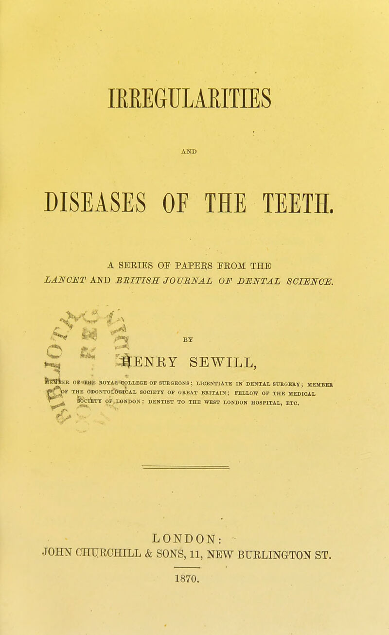 IRREGULARITIES AND DISEASES OF THE TEETH. A SERIES OF PAPERS FROM THE LANCET AND BRITISH JOURNAL OF DENTAL SCIENCE. * t*0^ BY '^ENKY SEWILL, IMIeR Of/JHE ROYAL^COLLEGE OP SURGEONS: LICENTIATE IN DENTAL SURGERY; MEMBER fjJPF THE <W>ONTOL6eiCAL SOCIETY OF GEEAT BRITAIN; FELLOW OF THE MEDICAL SOCIETY OF LONDON ; DENTIST TO THE WEST LONDON HOSPITAL, ETC LONDON: JOHN CHURCHILL & SONS, 11, NEW BURLINGTON ST. 1870.