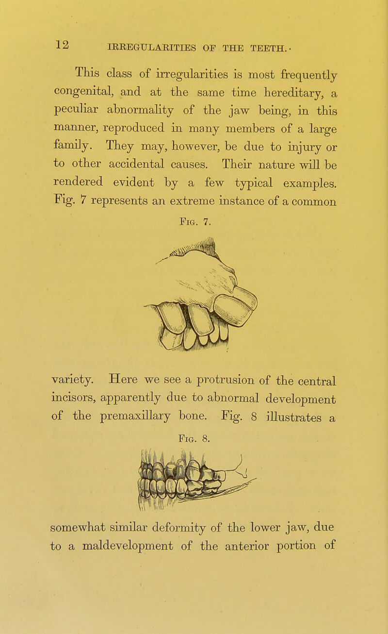 This class of irregularities is most frequently congenital, and at the same time hereditary, a peculiar abnormality of the jaw being, in this manner, reproduced in many members of a large family. They may, however, be due to injury or to other accidental causes. Their nature will be rendered evident by a few typical examples. Fig. 7 represents an extreme instance of a common Pig. 7. variety. Here we see a protrusion of the central incisors, apparently due to abnormal development of the premaxillary bone. Fig. 8 illustrates a Fig. 8. somewhat similar deformity of the lower jaw, due to a maldevelopment of the anterior portion of