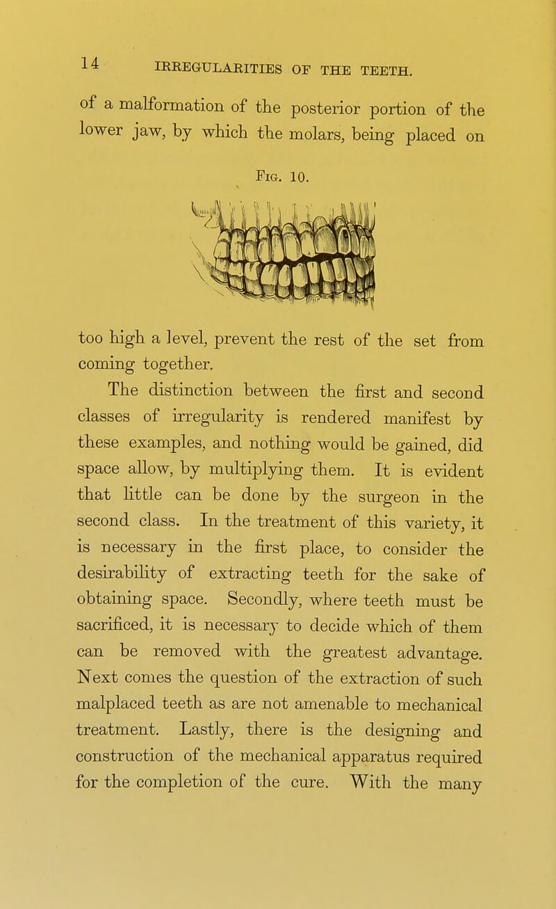 of a malformation of the posterior portion of the lower jaw, by which the molars, being placed on Fig. 10. too high a level, prevent the rest of the set from coming together. The distinction between the first and second classes of irregularity is rendered manifest by these examples, and nothing would be gained, did space allow, by multiplying them. It is evident that little can be done by the surgeon in the second class. In the treatment of this variety, it is necessary in the first place, to consider the desirability of extracting teeth for the sake of obtaining space. Secondly, where teeth must be sacrificed, it is necessary to decide which of them can be removed with the greatest advantage. Next comes the question of the extraction of such malplaced teeth as are not amenable to mechanical treatment. Lastly, there is the designing and construction of the mechanical apparatus required for the completion of the cure. With the many