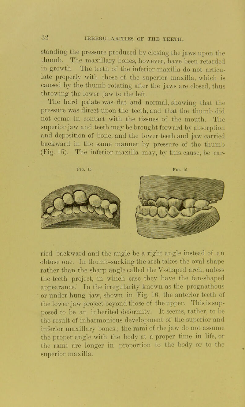 standing the pressure produced by closing tlie jcaws upon tiie thumb. The maxillary bones, however, have been retarded in growth. The teeth of the inferior maxilla do not articu- late properly with those of the superior maxilla, whiclj is caused by the thumb rotating after the jaws are closed, thus throwing the lower jaw to the left. The hard palate was flat and normal, showing that the pressure was direct upon the teeth, and that the thumb did not come in contact with the tissues of the mouth. The superior jaw and teeth may be brought forward by absorption and deposition of bone, and the lower teeth and jaw carried backward in the same manner by pressure of the thumlj (Fig. 15). The inferior maxilla may, by this, cause, be car- Fio. 15. Fio. IG. ried backward and the angle be a right angle instead of an obtuse one. In thumb-sucking the arch takes the oval shape rather than the sharp angle called the V-shaped arch, unless the teeth project, in which case they have the fan-shaped appearance. In the irregularity known as the prognathous or under-hung jaw, shown in Fig. 16, the anterior teeth of the lower jaw project beyond those of the upper. This is sup- posed to be an inherited deformity. It seems, rather, to he the result of inharmonious development of the superior and inferior maxillary bones; the rami of the jaw do not assume the proper angle with the body at a proper time in life, or the rami are longer in proportion to tlic body or to the superior maxilla.