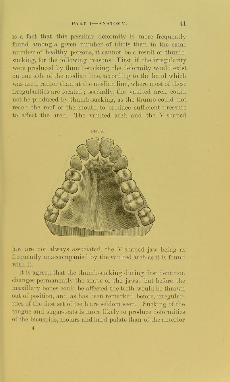 is a fact that this peculiar deformity is more frequently found among a given number of idiots than in the same number of healthy persons, it cannot be a result of thumb- sucking, for the following reasons: First, if the irregularity were produced by thumb-sucking, the deformity would exist on one side of the median line, according to the hand which was used, rather than at the median line, where most of these irregularities are located; secondl}'-, the vaulted arch could not be produced by thumb-sucking, as the thumb could not reach the roof of the mouth to produce sufficient pressure to affect the arch. The vaulted arch and the V-shaped Fig. 20. jaw are not always associated, the V-shaped jaw being as frequently unaccompanied by the vaulted arch as it is found with it. It is agreed that the thumb-sucking during first dentition changes permanently the shape of tlie jaws; but before the maxillary bones could be affected the teeth would be thrown out of position, and, as has been remarked before, irregular- ities of the first set of teeth are seldom seen. Sucking of the tongue and sugar-teats is more likely to produce deformities of the bicuspids, molars and hard palate than of the anterior 4