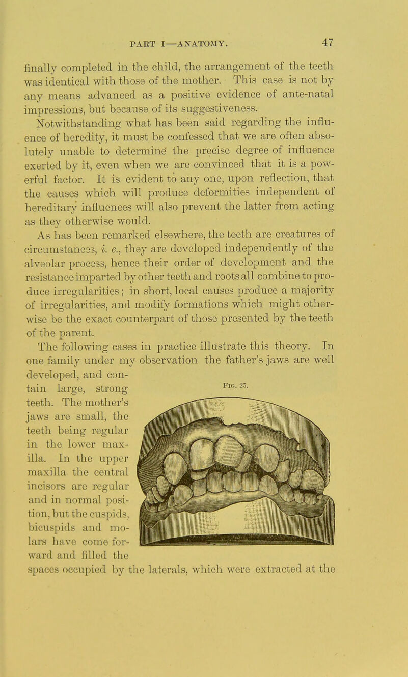 finally completed in the child, the arrangement of the teeth was identical with those of the mother. This case is not by any means advanced as a positive evidence of ante-natal impressions, but because of its suggestiveness. Notwithstanding what has been said regarding the influ- ence of heredity, it must be confessed that we are often abso- lutely unable to determine* the precise degree of influence exerted by it, even when we are convinced that it is a pow- erful factor. It is evident to any one, upon reflection, that the causes which will produce deformities independent of hereditary influences will also prevent the latter from acting as they otherwise would. As has been remarked elsewhere, the teeth are creatures of circumstances, i. e., they are developed independently of the alveolar process, hence their order of development and the resistance imparted by other teeth and roots all combine to pro- duce irregularities; in short, local causes produce a majority of irregularities, and modify formations which might other- wise be the exact counterpart of those presented by the teeth of the parent. The following cases in practice illustrate this theory. In one family under my observation the father's jaws are well developed, and con- tain large, strong teeth. The mother's jaws are small, the teeth being regular in the lower max- illa. In the upper maxilla the central incisors are regular and in normal posi- tion, but the cuspids, bicuspids and mo- lars have come for- ward and filled the spaces occupied by the laterals, which were extracted at