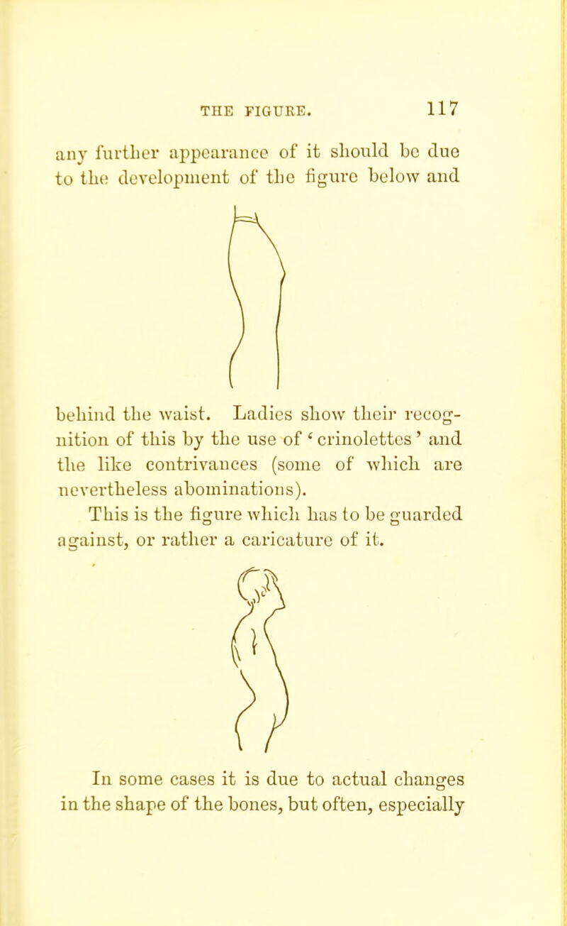 any further appearance of it should be due to the development of the figure below and behind the waist. Ladies show their recog- nition of this by the use of ' crinolettes ' and the like contrivances (some of which, are nevertheless abominations). This is the figure which has to be uarded against, or rather a caricature of it. In some cases it is due to actual changes in the shape of the bones, but often, especially
