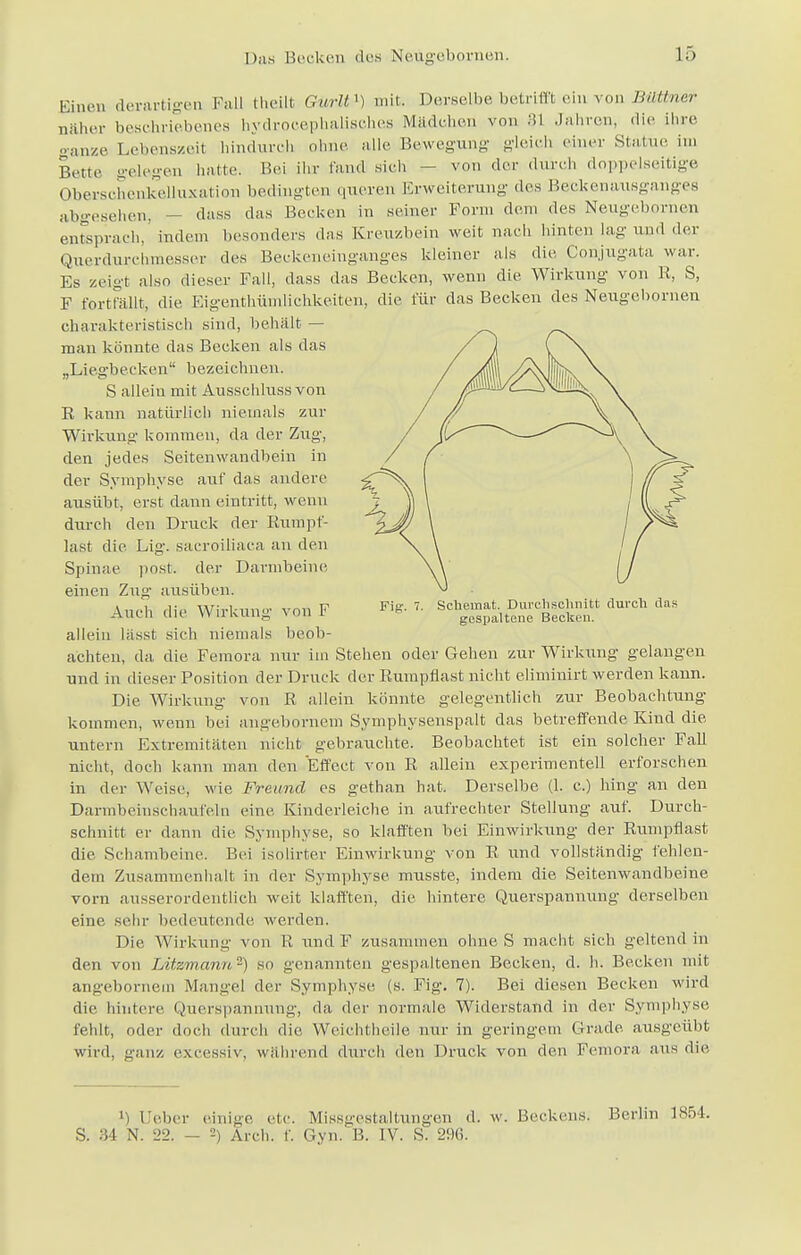 Einen derartigen Ball ttaeilt Gtorlt1) mit, Derselbe betrifft ein von B«ifriej> näher beschriebenes hydrocephalisches Mädchen von 31 Jahren, die ihre o-anze Lebenszeit hindurch ohne alle Bewegung gleich einer Statue im Bette gelegen hatte. Bei ihr fand sich — von der durch doppelseitige Oberscheukelluxation bedingten queren Erweiterung des Beckenausganges abgesehen, - dass das Becken in seiner Form dem des Neugebornen entsprach, indem besonders das Kreuzbein weit nach hinten lag und der Querdurehmesser des Beckeneinganges kleiner als die Conjugata war. Es zeigt also dieser Fall, dass das Becken, wenn die Wirkung von R, S, F fortfällt, die Eigentümlichkeiten, die für das Becken des Neugebornen charakteristisch sind, behält - man könnte das Becken als das „Liegbecken bezeichnen. S allein mit Ausschluss von R kann natürlich niemals zur Wirkung kommen, da der Zug, den jedes Seitenwandbein in der Symphyse auf das andere ausübt, erst dann eintritt, wenn durch den Druck der Rumpf- last die Lig. säcroiliaca an den Spinae post. der Darmbeine einen Zug ausüben. Auch die Wirkung von F allein läSSt sich niemals beob- achten, da die Femora nur im Stehen oder Gehen zur Wirkung gelangen und in dieser Position der Druck der Rumpflast nicht eliminirt werden kann. Die Wirkung von R allein könnte gelegentlich zur Beobachtung kommen, wenn bei angebornem Symphysenspalt das betreffende Kind die untern Extremitäten nicht gebrauchte. Beobachtet ist ein solcher Fall nicht, doch kann man den Effect von R allein experimentell erforschen in der Weise, wie Freund es gethan hat. Derselbe (1. c.) hing an den Darmbeinschaufelu eine Kinderleiche in aufrechter Stellung auf. Durch- schnitt er dann die Symphyse, so klafften bei Einwirkung der Rumpflast die Schambeine. Bei isolirter Einwirkung von R und vollständig fehlen- dem Zusammenhalt in der Symphyse musste, indem die Seitenwandbeine vorn ausserordentlich weit klafften, die hintere Querspannung derselben eine sehr bedeutende werden. Die Wirkung von R und F zusammen ohne S macht sich geltend in den von Litzmann-) so genannten gespaltenen Becken, d. h. Becken mit angebornem Mangel der Symphyse (s. Fig. 7). Bei diesen Becken wird die hintere Querspannung, da der normale Widerstand in der Symphyse fehlt, oder doch durch die Weichtheile nur in geringem Grade ausgeübt wird, ganz excessiv, wählend durch den Druck von den Femora aus die Schemat. Durchschnitt durch das gespaltene Becken. !) üeber einige etc. Missgestaltungen d. w. Beckens. Berlin 1854. S. 34 N. 22. - 2) Arch. f. Gyn. B. IV. S. 296.