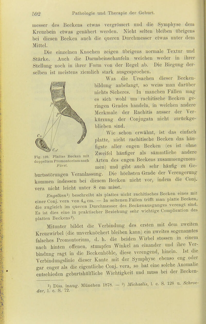 messer des Beckens etwas vergrössert und die Symphyse dem Kreuzbein etwas genähert werden. Nicht selten bleiben übrigens bei diesen Becken auch die queren Durchmesser etwas unter dem Mittel. Die einzelnen Knochen zeigen übrigens normale Textur und Stärke. Auch die Darmbeinschau lein weichen weder in ihrer Stellung noch in ihrer Form von der Regel ab. Die Biegung der- selben ist meistens ziemlich stark ausgesprochen. Was die Ursachen dieser Becken- bildung anbelangt, so weiss man darüber nichts Sicheres. In manchen Fällen mag es sich wohl um rachitische Becken ge- ringen Grades handeln, in welchen andere Merkmale der Rachitis ausser der Ver- kürzung der Conjugata nicht zurückge- blieben sind. Wie schon erwähnt, ist das einfach platte, nicht rachitische Becken das häu- tigste aller engen Becken (es ist ohne Zweifel häufiger als sämmtliche andere Fig. 129. Plattes Becken mit doppeltem Promontorium nach Fürst. Arten des engen Beckens zusammengenom- men) und gibt auch sehr häufig zu Ge- burtsstörungen Veranlassung. Die höchsten Grade der Verengerung kommen indessen bei diesem Becken nicht vor, indem die Conj. vera nicht leicht unter 8 cm misst. Engelken-1-) beschreibt als plattes nicht rachitisches Becken eines mit einer Conj. vera von 4,8 cm. — In seltenen Fällen trifft man platte Becken, die zugleich im queren Durchmesser des Beckenausganges verengt sind. Es ist dies eine in praktischer Beziehung sehr wichtige Complication des platten Beckens2). Mitunter bildet die Verbindung des ersten mit dem zweiten Kreuzwirbel (die unverknöchert bleiben kann) ein zweites sogenanntes falsches Promontorium, d. h. die beiden Wirbel stossen in einem nach hinten offenen, stumpfen Winkel an einander und ihre Ver- bindung ragt in die Beckenhöhle, diese verengend, hinein. Ist die Verbindungslinie dieser Kante mit der Symphyse ebenso eng oder gar enger als die eigentliche Conj. vera, so hat eine solche Anomalie entschieden geburtshiilfliche Wichtigkeit und muss bei der Becken- i) Diss. inaug. München 1878. der, 1. c. S. 72. 2) Michaelis, 1. c. S. 128 u. Schroe-
