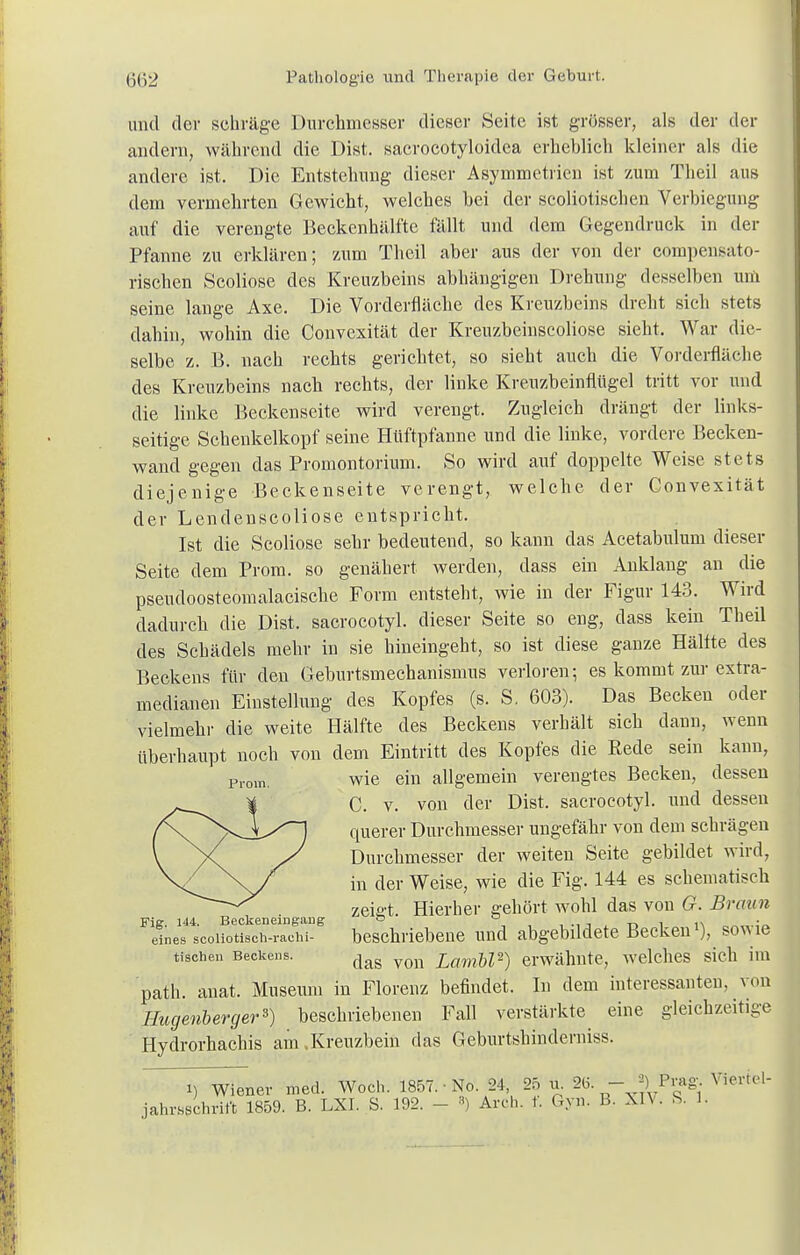 und der schräge Durchmesser dieser Seite ist grösser, als der der andern, während die Dist. sacrocotyloidea erheblich kleiner als die andere ist. Die Entstehung dieser Asymmetrien ist zum Theil aus dem vermehrten Gewicht, welches bei der scoliotischen Verbieguug auf die verengte Beckenhälfte fällt und dem Gegendruck in der Pfanne zu erklären; zum Theil aber aus der von der corapensato- rischen Scoliose des Kreuzbeins abhängigen Drehung desselben um seine lange Axe. Die Vorderfläche des Kreuzbeins dreht sich stets dahin, wohin die Convexität der Kreuzbeinscoliose sieht. War die- selbe z. B. nach rechts gerichtet, so sieht auch die Vorderfläche des Kreuzbeins nach rechts, der linke Kreuzbeinflügel tritt vor und die linke Beckenseite wird verengt. Zugleich drängt der links- seitige Schenkelkopf seine Hüftpfanne und die linke, vordere Becken- wand gegen das Promontorium. So wird auf doppelte Weise stets diejenige Beckenseite verengt, welche der Convexität der Lendenscoliose entspricht. Ist die Scoliose sehr bedeutend, so kann das Acetabulum dieser Seite dem Prora, so genähert werden, dass ein Anklang an die pseudoosteomalacische Form entsteht, wie in der Figur 143. Wird dadurch die Dist. sacrocotyl. dieser Seite so eng, dass kein Theil des Schädels mehr in sie hineingeht, so ist diese ganze Hälfte des Beckens für den Geburtsmechanismus verloren; es kommt zur extra- medianen Einstellung des Kopfes (s. S. 603). Das Becken oder vielmehr die weite Hälfte des Beckens verhält sich dann, wenn überhaupt noch von dem Eintritt des Kopfes die Rede sein kann, wie ein allgemein verengtes Becken, dessen C. v. von der Dist. sacrocotyl. und dessen querer Durchmesser ungefähr von dem schrägen Durchmesser der weiten Seite gebildet wird, in der Weise, wie die Fig. 144 es schematisch zeigt. Hierher gehört wohl das von G. Braun Fig. 144. Beckeneingang ° ° _ . • eines scoiiotisch-rachi- beschriebene und abgebildete Becken1), sowie tischen Beckens. ^ yon £flm&Z2) erwähnte, welches sich im path. anat. Museum in Florenz befindet. In dem interessanten, von Hugenberger*) beschriebenen Fall verstärkte eine gleichzeitige Hydrorhachis am .Kreuzbein das Geburtshinderniss. i) Wiener med. Woch. 1857. • No. 24 25 u. 2(5. -J)i Prag. Viertel- jahrsschrift 1859. B. LXI. S. 192. - ') Arch. t. Gyn. B. XIV. S. 1. Proin.