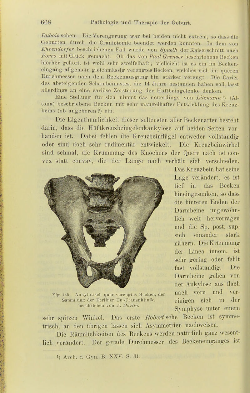 Dubais''sehen. Die Verengerung war bei beiden nicht extrem, so das» die Geburten durch die Craniotomie beendet werden konnten. In dein von Ehrendorfer beschriebenen Fall wurde von Spaeth der Kaiserschnitt nach Porro mit Glück gemacht. Ob das von Paul Grenser beschriebene Becken hierher gehört, ist wohl sehr zweifelhaft; vielleicht ist es ein im Becken- eingang allgemein gleichmässig verengtes Becken, welches sich im queren Durchmesser nach dem Beckenausgang hin stärker verengt Die Caries des absteigenden Schambeinastes, die 14 Jahre bestanden haben soll, lässt allerdings an eine cariöse Zerstörung der Hüftbeingelenke denken. Eine Stellung für sich nimmt das neuerdings von Litzmann1) (Al- tona) beschriebene Becken mit sehr mangelhafter Entwicklung des Kreuz- beins (ob angeboren '?) ein. Die Eigenthümliöhkeit dieser seltensten aller Beckenarten besteht darin, dass die Hüftkretizheiiig'elenkankylosc auf beiden Seiten vor- banden ist. Dabei fehlen die Kreuzbeinflügel entweder vollständig oder sind doch sehr rudimentär entwickelt. Die Kreuzbeinwirbel sind schmal, die Krümmung des Knochens der Quere nach ist con- vex statt convav, die der Länge nach verhält sich verschieden. sehr spitzen Winkel. Das erste Bobert'scke Becken ist symme- trisch, an den übrigen lassen sich Asymmetrien nachweisen. Die Räumlichkeiten des Beckens werden natürlich ganz wesent- lich verändert, Der gerade Durchmesser des Beckeneinganges ist l) Arch. f. Gyn. B. XXV. S. 31. Fig. 145 Aukylotisch quer verengtes Becken, der Sammlung der Berliner Un.-Frauenklinik. beschrieben von A. Martin. Das Kreuzbein hat seine Lage verändert, es ist tief in das Becken hineingesunken, so dass die hinteren Enden der Darmbeine ungewöhn- lich weit hervorragen und die Sp. post. sup. sich einander stark nähern. Die Krümmung der Linea innom. ist sein1 gering oder fehlt fast vollständig. Die Darmbeine gehen von der Ankylose aus flach nach vorn und ver- einigen sich in der Symphyse unter einem