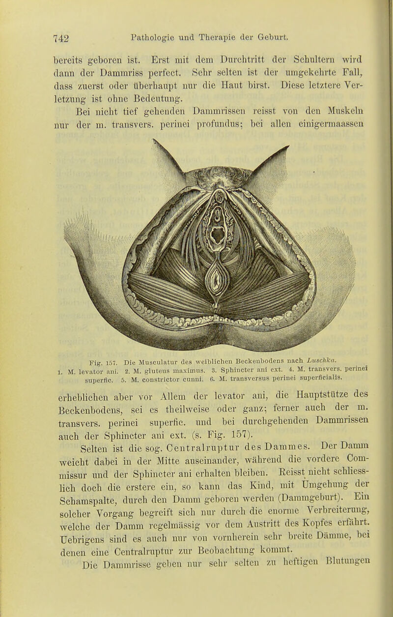 bereits geboren ist. Erst mit dem Durchtritt der Schultern wird dann der Dammriss perfcct. Sehr selten ist der umgekehrte Fall, dass zuerst oder überhaupt nur die Haut birst. Diese letztere Ver- letzung ist ohne Bedeutung. Bei nicht tief gehenden Dammrissen reisst von den Muskeln nur der m. transvers. perinei profundus; bei allen einigermaassen Fig. 157. Die Musculatur des weiblichen Beckenbodens nach Luschka. 1. M. levator ani. 2. M. gluteus maximus. 3. Sphincter ani ext. 4. M. transvers. perinei superfic. 5. M. constrictor cunni. 6. M. transversus perinei superficialis. erheblichen aber vor Allem der levator ani, die Hauptstütze des Beckenbodens, sei es theilweise oder ganz; ferner auch der m. transvers. perinei superfic. und bei durchgehenden Dammrissen auch der Sphincter ani ext. (s. Fig. 157). Selten ist die sog. Centrairuptur des Dammes. Der Damm weicht dabei in der Mitte auseinander, während die vordere Com- inissur und der Sphincter ani erhalten bleiben. Reisst nicht schliess- lich doch die erstere ein, so kann das Kind, mit Umgehung der Schamspalte, durch den Damm geboren werden (Daramgeburt). Ein solcher Vorgang begreift sich nur durch die enorme Verbreiterung, welche der Damm regelmässig vor dem Austritt des Kopfes erfährt. Uebrigens sind es auch nur von vornherein sehr breite Dämme, bei denen eine Centrairuptur zur Beobachtung kommt. Die Dammrisse geben nur sehr selten zu heftigen Blutungen