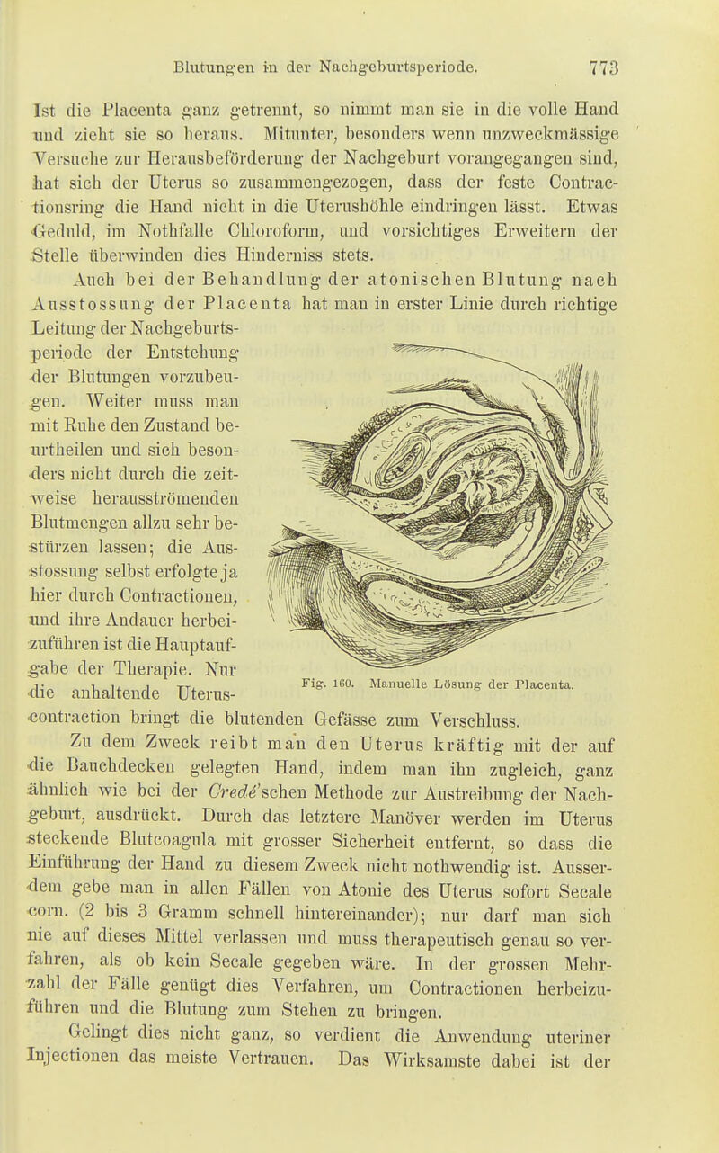 Ist die Placenta ganz getrennt, so nimmt man sie in die volle Hand und zieht sie so heraus. Mitunter, besonders wenn unzweckmässige Versuche zur Herausbeförderung der Nachgeburt vorangegangen sind, bat sich der Uterus so zusammengezogen, dass der feste Contrac- tionsring die Hand nicht in die Uterushöhle eindringen lässt. Etwas Geduld, im Nothfalle Chloroform, und vorsichtiges Erweitern der .Stelle überwinden dies Hinderniss stets. Auch bei der Behandlung der atonischen Blutung nach Ansstossung der Placenta hat man in erster Linie durch richtige Leitung der Nachgeburts- periode der Entstehung 4er Blutungen vorzubeu- gen. Weiter muss man mit Ruhe den Zustand be- urtheilen und sich beson- ders nicht durch die zeit- weise herausströmenden Blutmengen allzu sehr be- stürzen lassen; die Aus- stossung selbst erfolgte ja hier durch Contractionen, und ihre Andauer herbei- zuführen ist die Hauptauf- gabe der Therapie. Nur •die anhaltende Uterus- ■contraction bringt die blutenden Gefässe zum Verschluss. Zu dem Zweck reibt man den Uterus kräftig mit der auf ■die Bauchdecken gelegten Hand, indem man ihn zugleich, ganz ähnlich wie bei der Crede sehen Methode zur Austreibung der Nach- geburt, ausdrückt. Durch das letztere Manöver werden im Uterus steckende Blutcoagula mit grosser Sicherheit entfernt, so dass die Einführung der Hand zu diesem Zweck nicht nothwendig ist. Ausser- dem gebe man in allen Fällen von Atonie des Uterus sofort Seeale corn. (2 bis 3 Gramm schnell hintereinander); nur darf man sich nie auf dieses Mittel verlassen und muss therapeutisch genau so ver- fahren, als ob kein Seeale gegeben wäre. In der grossen Mehr- zahl der Fälle genügt dies Verfahren, um Contractionen herbeizu- führen und die Blutung zum Stehen zu bringen. Gelingt dies nicht ganz, so verdient die Anwendung uteriner Injectionen das meiste Vertrauen. Das Wirksamste dabei ist der Fig. 1G0. Manuelle Lösung der Placenta.