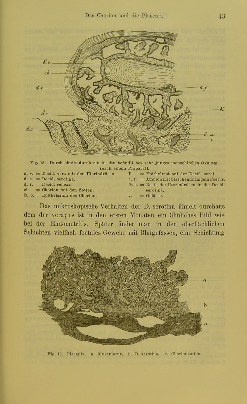 Fig. 18. Durchsclinitt duroh ein in situ befindliches sehr junges menschliches Ovulnm (nach einem Praparat). d. V. = Decid. vera mit den Uterindrusen. di 8. = Decid. serotina. d. r. = Decid. reflexa. ch. = Chorion mit den Zotten. E. o. = Epithelsaum des Cliorion. E. = Epithelrest anf iler Decid. serot. a. f. — Amnion mit blaschenformigem Foetus. G. n. = Reste der Uterindrusen in der Decid. serotina. V. = Gefasse. Das mikroskopische Verhalten der D. serotina ahnelt durchaus dem der vera; es ist in den ersten Monaten ein ahnliches Bild wie bei der Endometritis. Spater findet man in den oberflachliclien ScWeliten vielfach foetales Gewebe mit Blatgefassen, eine Schiclitung- Fig. 19. Placenta, a. Mutjculaiur, h. D. serotina. c. Cliorionzotten.