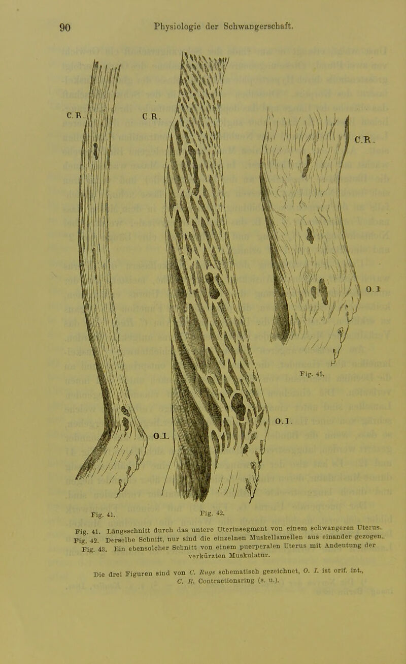 C.R 0 1 Fig. 41. Fig. 42. Fig. 41. LangSBchnitt durch flas untere Uterinsegment von einem scbwangeren Uterus. Fig 42 Df-raolbe Scbnitt, nvir siiid die einzelnen Muskellamellen aiis einander gezogen. Fig. 43. Ein ebensolcher Scljnitt von einem puerpcralen Uterus mit Andeutung der verkurzten Muskulatur. Die drei Figuren siiid von f. nuge sohematiscli gezelchnet, 0. I. ist orif. int., C. li. Contractionsring (s. u.).