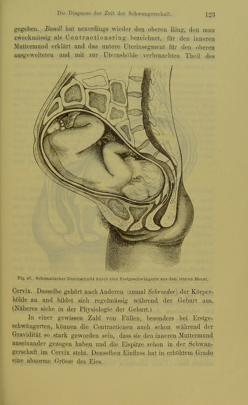gegebeu. JBandl hat ueuerclings wieder den obereu Ring, den man z^i^eckm^issig als Contractionsring bezeichnet, fltr den inueren Muttermnnd erkliirt und das iintere Uterinsegraent fur den oberen ausgeweiteten und mit zur Uterushohle verl)rauchten Theil des Fig. 47. Schematischer Durchschnitt durch eiiie Erstgeschwangerte aus dem letzlen Mouat. Cervix. Dasselbe gebort nacli Anderen (zumal Schroeder) der Korper- hehle an und bildet sich regelmassig wahrend der Geburt aus^ (Naheres siehe in der Physiologic der Geburt.) In einer gewissen Zahl von Fallen, besonders bei Erstg;e- schwangerten, konnen die Contraetionen auch schon wahrend der Graviditat so stark geworden sein, dass sie den inneren Muttermnnd auseinander gezogen haben und die Eispitze schon in der Schwan- gerschaft im Cervix steht. Denselben Einfluss hat in erhohtem Grade eine abnorme GrOsse des Eies.
