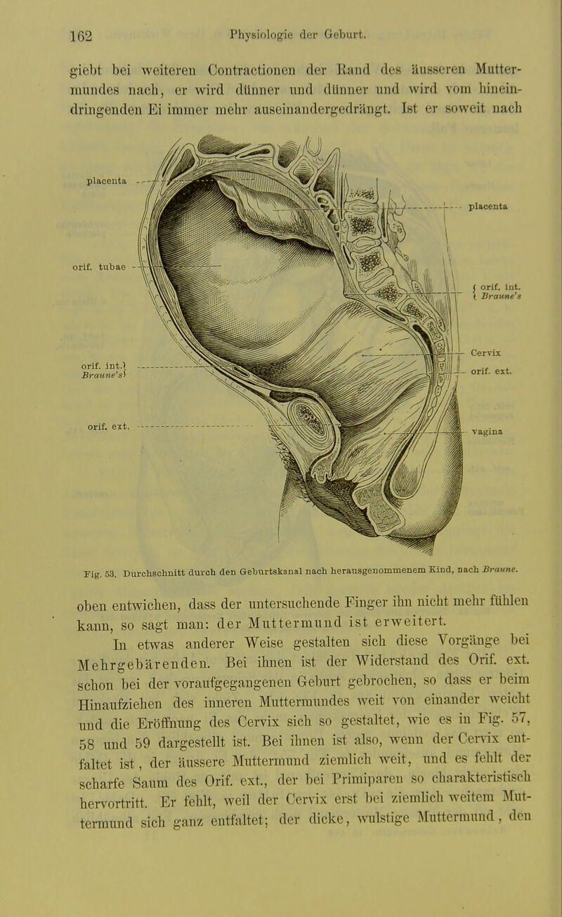 giebt bei weiteren Contractionen der Rand des ausseren Mutter- mundes nacli, er wird diinner und dUnner und wird vom hinein- dringenden Ei immer mehr auseinaudergedriingt. Ist er soweit uach rig. 53. Durclischnitt durch den Geburtskanal nacli heransgenommenem Kind, nach Braune. oben entwichen, dass der imtersucbende Finger ihn nicht mehr fiililen kann, so sagt man: der Muttermund ist erweitert. lu etwas anderer Weise gestalten sicli diese Vorgiinge bei Mehrgebarenden. Bei ibnen ist der Widerstand des Orif. ext. scbon bei der voraufgegangenen Gebiirt gebrochen, so dass er beira Hinaufziehen des inneren Muttermundes weit von einander weiclit und die Eroffnung des Cervix sicb so gestaltet, wie es in Fig. 57, 58 und 59 dargestellt ist. Bei ihnen ist also, wenn der Cervix ent- faltet ist, der aussere Muttermund zieralich weit, und es feblt der scharfe Saum des Orif. ext., der bei Frimii^aren so charakteristiscli hervortritt. Er feblt, weil der Cervix erst bei ziemlicb weitem Mut- termund sicb ganz entfaltet; der dicke, wulstige Muttermund, den