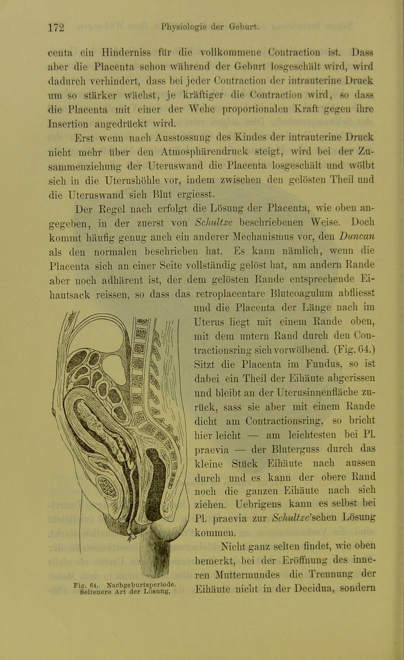 ceuta ein Hinderniss fiir die vollkommene Contraction ist, Dass aber die Placenta sclion willirend der Geburt losgeschiilt wird, wird dadurcli verhiudert, dass bei jeder Contraction der intrauterine Druck iim so starker waclist, je kraftiger die Contraction wird, so dass die Placenta mit einer der Wehe proportionaleu Kraft gegen ihre Insertion angedrlickt wird. Erst wenu nacli Ausstossung des Kindes der intrauterine Druck uiclit melir liber den Atmospliarendruck steigt, wird bei der Zu- sammenziebung der Uteruswand die Placenta losgeschalt und wolbt sicb in die Uterusliohle vor, indem zwischen den gelosten Theil und die Uteruswand sicb Rlut ergiesst. Der Kegel nacb erfolgt die Losung der Placenta, \vie oben an- gegeben, in der zuerst von ScliuUze bescbriebeuen Weise. Doch kommt baufig genug aucb ein anderer Mecbanisraus vor, den Duncan als den normalen bescbrieben bat. Es kann namlicb, wenu die Placenta sicb an einer Seite vollstandig gelost bat, am anderu Rande aber uocb adbareut ist, der dem gelosten Rande eutsprecbeude Ei- bautsack reissen, so dass das reti-oplaceutare Blutcoagulum abfliesst und die Placenta der Lange nacb im Uterus liegt mit einem Rande oben, mit dem untern Rand durcb den Con- Il^^iR^5fe'^''''f ^/1% tractionsring sicbvorwolbend. (Fig. 64.) l^lS^K^^W m \i\ Placenta im Fundus, so ist  dabei ein Tbeil der Eibaute abgerissen und bleibt an der Uterusinnenflacbe zu- riick, sass sie aber mit einem Rande dicbt am Contractionsring, so bricbt bier leicbt — am leicbtesten bei PI. praevia — der Bluterguss durcb das kleine Stiick Eibaute nacb ausseu durcb und es kann der obere Rand uocb die gauzen Eibaute nacb sicb zieben. Uebrigens kann es selbst bei PI. praevia zur ^Sc/iw^/^e'scben Losung kommeu. Nicbt ganz selten findet, wie oben bemerkt, bei der EroiTnuug des inue- ren Muttermundes die Treunung der ^s';uenerf A^ftTLL^ng' EibUutc uicbt iu dcr Dccidua, soudem