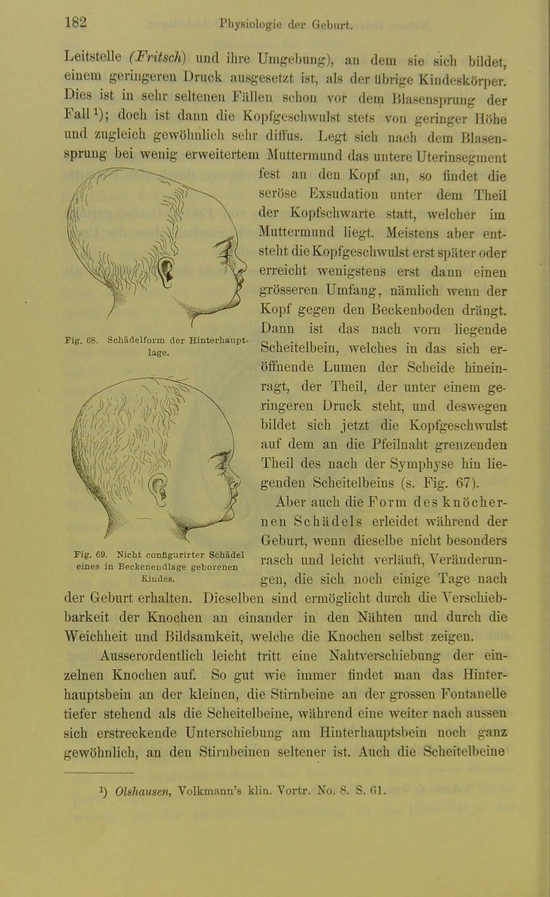 Leitstelle (Fritsch) unci ihve Umgebuiig), an dem sie fsicli bildet, eiuem geringeren Druck ausgesetzt ist, als der Ubrige Kindeskorper. Dies ist in sehr seltenen Fallen schon vor dem Blaseusprung der FalP); docli ist dann die Kopfgeschwiilst stets von geringer Hohe iind ziigleich gewohnlicli sehr diffus, Legt sich nacli dem Blasen- sprung bei wenig erweitertem Muttermund das untere Uterinsegment fest an den Kopf an, so findet die serose Exsudation unter dem Tbeil der Kopfscliwarte statt, welcher im Muttermund liegt. Meistens aber ent- steht dieKopfgeschwulst erst spater oder erreicht wenigstens erst dann einen grosseren Umfang, namlich wenn der Kopf gegen den Beckenboden drangt. Dann ist das nach voru liegende Scheitelbein, welches in das sich er- ()lfnende Lumen der Scheide hinein- ragt, der Theil, der unter einem ge- ringeren Druck steht, und desAvegen bildet sich jetzt die Kopfgeschwulst auf dem an die Pfeilnaht grenzenden Theil des nach der Symphyse bin lie- gen den Scheitelbeins (s. Fig. 67). Aber auch die Form des knocher- nen Schadels erleidet wahrend der Geburt, wenn dieselbe nicht besonders rasch und leicht verlauft, Verauderun- gen, die sich noch einige Tage nach der Geburt erhalten. Dieselben sind ermoglicht durch die Verschieb- barkeit der Knoohen an einander in den Nahten und durch die Weichheit und Bildsamkeit, welche die Knochen selbst zeigen. Ausserordentlich leicht tritt eine Nahtverschiebung der eiu- zelnen Knochen auf. So gut wie immer findet man das Hinter- hauptsbein an der kleinen, die Stirnbeine an der grosseu Fontanelle tiefer stehend als die Scheitelbeine, wahrend eine welter nach aussen sich erstreckende Unterschiebung am Hinterhauptsbein noch ganz gewohnlich, an den Stirnbeinen seltener ist. Auch die Scheitelbeine Fig. 68. Schadelform der Hinterliaupt- lage. Fig. 69. Nicht configurirter Schadel eines in Beckeneudlage geborenen Eindes. ^) Olshaiisen, Volkmann's klin. Vortr. No. 8. S. Gl.