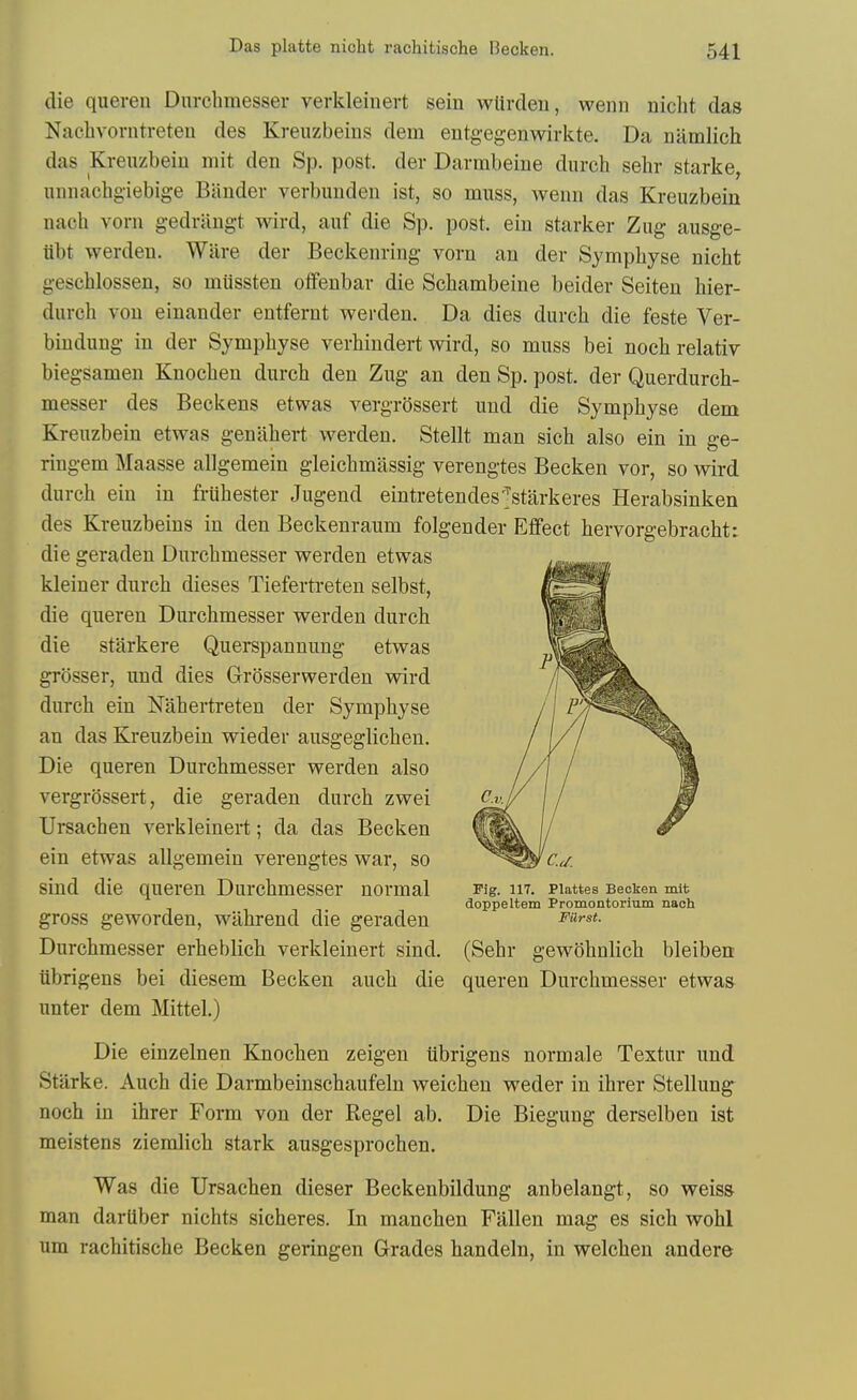 die quereu Dnrchmesser verkleiuert sein wtirdeii, wenn nicht das Nachvorntreten des Kreuzbeins dem entgegenwirkte. Da namlich das Kreuzbein mit den Sp. post, der Darrabeine durch sebr starke, nniiachgiebige Bander verbunden ist, so muss, wenn das Kreuzbein nach vorn gedrangt wird, auf die Sp. post, ein starker Zug ausge- tibt werden. Ware der Beckenring vorn an der Symphyse nicht geschlossen, so miissten offenbar die Schambeine beider Seiten hier- durch von einander entfernt werden. Da dies durch die feste Ver- bindung in der Symphyse verhindert wird, so muss bei nochrelativ biegsamen Knochen durch den Zug an den Sp. post, der Querdurch- messer des Beckens etwas vergrossert uud die Symphyse dem Kreuzbein etwas genahert werden. Stellt man sich also ein in ge- riugem Maasse allgemein gleichmassig verengtes Becken vor, so wird durch ein in fruhester Jugend eintretendes'Jstarkeres Herabsinken des Kreuzbeins in den Beckenraum folgender Effect hervorgebracht: die geraden Dnrchmesser werden etwas kleiner durch dieses Tiefertreten selbst, die queren Dnrchmesser werden durch die starkere Querspannung etwas grosser, und dies Glrosserwerden wird durch ein Nahertreten der Symphyse an das Kreuzbein wieder ausgeglichen. Die queren Dnrchmesser werden also vergrossert, die geraden durch zwei Ursachen verkleinert; da das Becken ein etwas allgemein verengtes war, so sind die queren Durchmesser normal Pig. m. piattes Becken mit doppeltem Promontorium nach gross geworden, wilhrend die geraden Durchmesser erheblich verkleinert sind. (Sehr gewohnlich bleiben iibrigens bei diesem Becken auch die queren Durchmesser etwas unter dem Mittel.) Die einzelnen Knochen zeigen iibrigens normale Textur und Starke. Auch die Darmbeinschaufeln weicheu weder in ihrer Stellung noch in ihrer Form von der Kegel ab. Die Biegung derselben ist meistens ziemlich stark ausgesprochen. Was die Ursachen dieser Beckenbildung anbelangt, so weiss man darilber nichts sicheres. In manchen Fallen mag es sich wohl urn rachitische Becken geringen Grades handeln, in welchen andere