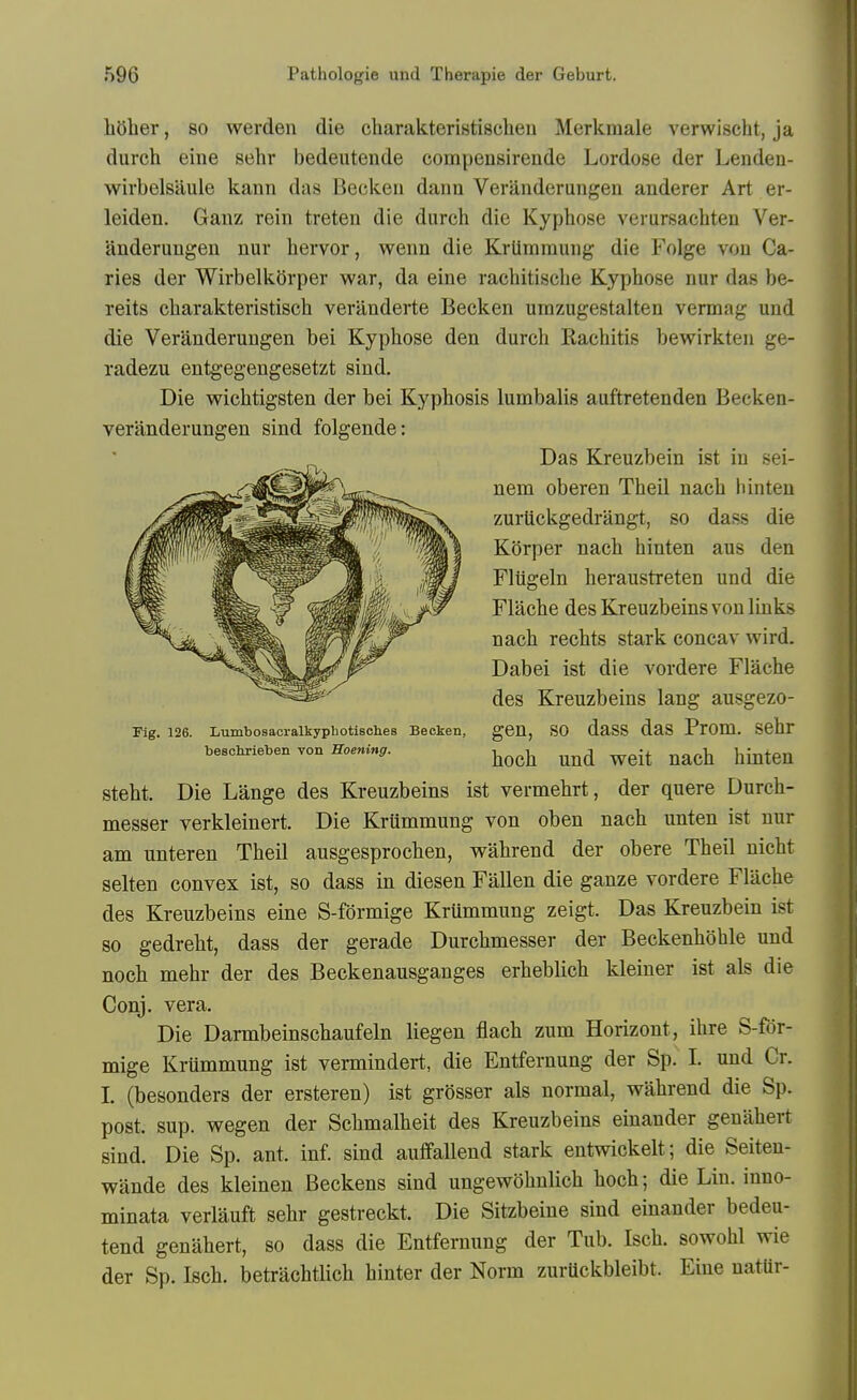 liOher, 80 werden die charakteristischeu Merkmale verwischt, ja durch eine sehr bedeutende compensirende Lordose der Lenden- wirbelsiiule kann das Beckeu daim Veranderungen anderer Art er- leiden. Ganz rein treten die durch die Kyphose verursachten Ver- anderungen nur hervor, wenn die Krlimraung die Folge vou Ca- ries der Wirbelkorper war, da eine rachitisclie Kyphose nur das be- reits charakteristisch veranderte Becken urazugestalten vermag und die Veranderungen bei Kyphose den durch Rachitis bewirkten ge- radezu entgegengesetzt sind. Die wichtigsten der bei Kyphosis lumbalis auftretenden Becken- veranderungen sind folgende: steht. Die Lange des Kreuzbeins ist vermehrt, der quere Durch- messer verkleinert. Die Krummung von oben nach unten ist nur am nnteren Theil ausgesprochen, wahrend der obere Theil nicht selten convex ist, so dass in diesen Fallen die ganze vordere Flache des Kreuzbeins eine S-formige Krummung zeigt. Das Kreuzbein ist so gedreht, dass der gerade Durchmesser der Beckenhohle und noch mehr der des Beckenausganges erheblich kleiner ist als die Conj. vera. Die Darmbeinschaufeln liegen flach zum Horizont, ihre S-for- mige Krummung ist vermindert, die Entfernung der Sp. I. und Cr. I. (besonders der ersteren) ist grosser als normal, wahrend die Sp. post. sup. wegen der Schmalheit des Kreuzbeins einander genahert sind. Die Sp. ant. inf. sind auffallend stark entwickelt; die Seiteu- wande des kleinen Beckens sind ungewohnlich hoch; die Lin. inno- minata verlauft sehr gestreckt. Die Sitzbeine sind einander bedeu- tend genahert, so dass die Entfernung der Tub. Isch. sowohl wie der Sp. Isch. betrachtlich hinter der Norm zurUckbleibt. Eine uatUr- Fig. 126. Lumbosacralkypbotisches Becken, beschrieben von Hoening. Das Kreuzbein ist iu sei- nem oberen Theil nach hinteu zurttckgedrangt, so dass die Korper nach hinten aus den Fltigeln heraustreten und die Flache des Kreuzbeins vou links nach rechts stark concav wird. Dabei ist die vordere Flache des Kreuzbeins lang ausgezo- gen, so dass das Prom, sehr hoch und weit nach hinten