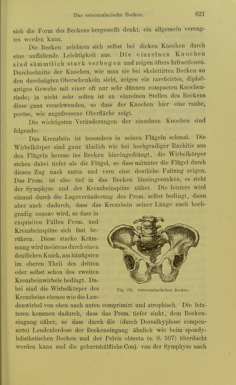 sich die Form des Beckeiis hergestellt denkt, ein allg-emein vereng- tes werden kanii. Die Becken zeiclinen sicli selbst bei dicken Knoclien durch eine 'auttallende Leicbtigkeit aus. Die eiuzelnen Knoclien sind siimmtlich stark verbogen iind zeigen oftersInfractiouen. Durchschnitte der Knochen, wie man sie bei skelettirten Becken an den durchsagten Oberschenkeln sieht, zeigen ein rareficirtes, diploe- artiges Gewebe mit einer oft nur sehr dUnnen compacten Knochen- rinde; ja nicht sehr selten ist an einzelnen Stellen des Beckens diese ganz verscliwuuden, so dass der Knoclien hier eine rauhe, porose, wie angefressene Oberflacbe zeigt. Die wiclitigsten Veriinderungen der einzelnen Knoclien sind folgende: Das Kreuzbein ist besonders in seinen Flugeln schmal. Die Wirbelkorper sind ganz abnlich wie bei hochgradiger Rachitis aus den Fliigeln beraus ins Becken liineingedrangt, die Wirbelkorper stehen dabei tiefer als die Flugel, so dass mitunter die Flugel durch diesen Zug nach unten und vorn eine deutliche Faltung zeigen. Das Prom, ist also tief in das Becken hineingesunken, es steht der Symphyse und der Kreuzbeinspitze naher. Die letztere wird einmal durch die Lageveranderung des Prom, selbst bedingt, dann aber auch dadurch, dass das Kreuzbein seiner Lange nach hoch- gradig concav wird, so dass in exquisiten Fallen Prom, und Kreuzbeinspitze sich fast be- riihren. Diese starke Krilm- mung wirdmeistens durch einen deutlichen Knick, am haufigsten im oberen Theil des dritten oder selbst schon des zweiten Kreuzbeinwirbels bedingt. Da- bei sind die Wirbelkorper des rig. 133. osteomaiacisches Becken. Kreuzbeins ebenso wie die Len- denwirbel von oben nach unten comprimirt und atrophisch. Die letz- teren kommen dadurch, dass das Prom, tiefer sinkt, dem Beoken- eingang naher, so dass durch die (durch Dorsalkyphose compen- sirte) Lendenlordose der Beckeneingang ahnlich wie beim spondy- lolisthetischen Becken und der Pelvis obtecta (s. S. 597) iiberdacht werden kann und die geburtshltlfliche Conj. von der Symphyse nach.