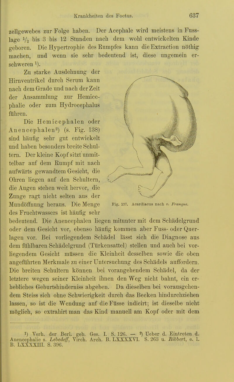 zellgewebes zur Folge haben. Der Acepliale wird meistens in Fuss- lage V2 bis 8 bis 12 Stunden nacli dem wohl entwickelten Kinde geboren. Die Hypertrophie des Rumpfes kann die Extraction notWg- macheti, nnd wenn sie sehr bedeutend ist, diese nngemein er- scbweren ^). Zu Starke Aiisdebnung der Hirnventi-ikel durch Serum kann nacli dem Grade nnd nach der Zeit der Ansammlung zur Hemice- pbalie oder zum Hydrocephalus fUhren. Die Hemicephalen oder Anencephalen^) (s. Fig. 188) sind haufig sehr gut entwickelt imd haben besonders breite Schul- tern. Der kleine Kopf sitzt unmit- telbar auf dem Rumpf mit nach aufwarts gewandtem Gesicht, die Ohren liegen auf den Schultern, die Angen stehen weit hervor, die Znnge ragt nicht selten aus der MundoffnUng heraUS. Die Menge ^ig, 137. Aoardlaous nach ». Franque. des Fruchtwassers ist haufig sehr bedeutend. Die Anencephalen liegen mitunter mit dem Schadelgrund oder dem Gesicht vor, ebenso haufig kommen aber Fuss- oder Quer- lagen vor. Bei vorliegendem Schadel lasst sich die Diagnose aus- dem fllhlbaren Schadelgrund (Tiirkensattel) stellen und auch bei vor- liegendem Gesicht miissen die Kleinheit desselben sowie die oben angefiihrten Merkmale zu einer Untersuchung des Schadels auifordern. Die breiten Schultern konnen bei vorangehendem Schadel, da der letztere wegen seiner Kleinheit ihnen den Weg nicht bahnt, ein er- hebliches Geburtshinderniss abgeben. Da dieselben bei vorausgehen- dem Steiss sich ohne Schwierigkeit durch das Becken hindurchziehen lassen, so ist die Wen dung auf dieFtisse indicirt; ist dieselbe nicht mSglich, so extrahirt man das Kind manuell am Kopf oder mit dem 1) Verb, der Berl. geb. Ges. I. S. 126. — 2) Ueber d. Eintreten d. Anencepbalie s. Lebedeff, Vircb. Arcb. B. LXXXXVI. S. 263 u. Bibbert, e. L B. LXXXXIII. S. 396.