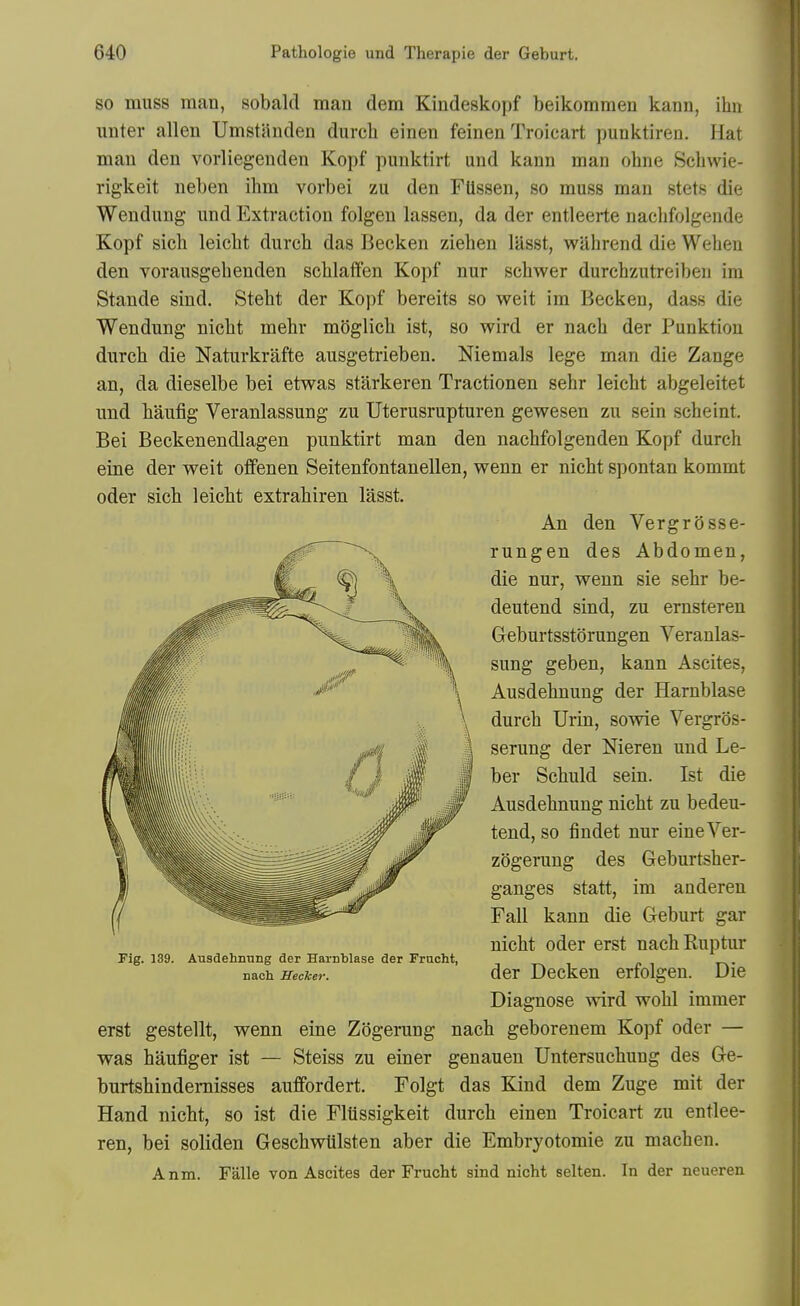 SO muss man, sobald man dem Kindeskopf beikommen kann, ihn unter alien Umstanden durcli einen feinen Troicart punktiren. Hat man den vorliegeuden Kopf punktirt und kann man ohne Schwie- rigkeit neben ihm vorbei zu den FUssen, so muss man stets die Wendung und Extraction folgen lassen, da der entleerte uaclifolgende Kopf sicb leicht durch das Becken ziehen lasst, wahrend die Wehen den vorausgebenden scblaffen Kopf nur scbwer durcbzutreiben im Stande sind. Stebt der Kopf bereits so weit im Becken, dass die Wendung nicbt mebr moglicb ist, so wird er nacb der Punktiou durcb die Naturkrafte ausgetrieben. Niemals lege man die Zange an, da dieselbe bei etwas starkeren Tractionen sehr leicht abgeleitet und baufig Veranlassung zu Uterusrupturen gewesen zu sein scheint. Bei Beckenendlagen punktirt man den nacbfolgenden Kopf durch eine der weit offenen Seitenfontanellen, wenn er nicbt spontan kommt An den Vergrosse- rungen des Abdomen, die nur, wenn sie sehr be- deutend sind, zu ernsteren Greburtsstorungen Veranlas- sung geben, kann Ascites, Ausdehnung der Harnblase durch Urin, sowie Vergros- serung der Nieren und Le- ber Schuld sein. Ist die Ausdehnung nicbt zu bedeu- tend, so findet nur eineVer- zogerung des Geburtsher- ganges statt, im anderen Fall kann die Geburt gar nicbt oder erst nach Ruptur Fig. 139. Ausdehnung der Harnblase der Frucht, nach Becker. dcr Deckcu crfolgcn. Die Diagnose wird wohl immer erst gestellt, wenn eine Zogerung nach geborenem Kopf oder — was baufiger ist — Steiss zu einer genauen Untersuchung des Ge- burtshindemisses auflfordert. Folgt das Kind dem Zuge mit der Hand nicbt, so ist die Fliissigkeit durch einen Troicart zu entlee- ren, bei soliden Geschwlilsten aber die Embryotomie zu machen. Anm. Falle von Ascites der Frucht sind nicht selten. In der neueren