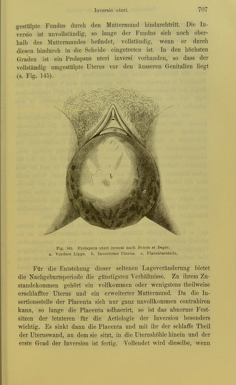 gestUlpte Fundus durch den Muttermund hindurchtritt. Die In- versio ist unvoUstiindig, so lauge der Fundus sich noch ober- halb des Muttermundes befindet, vollstandig, wenn er durch diesen hindurch in die Scheide eingetreten ist. In den hSchsten Gra'den ist ein Prolapsus uteri inversi vorhanden, so dass der vollstandig umgesttilpte Uterus vor den ausseren Genitalien liegt (s. Fig. 145). Fig. 145. Prolapsiis uteri inversi nach Boivin et Bugis. a. Vordere Lippe. b. Invertirter Uterus, c. Placentarstelle, Ftir die Entstehung dieser seltenen Lageveranderung bietet die Nacbgeburtsperiode die giinstigsten Verhaltnisse. Zu ihrem Zu- standekommen gehort ein vollkommen oder vrenigstens theilweise erscblaffter Uterus und ein erweiterter Muttermund. Da die In- sertionsstelle der Placenta sich nur ganz unvollkommen contrabiren kann, so lange die Placenta adhaerirt, so ist das abnorme Fest- sitzen der letzteren ftir die Aetiologie der Inversion besonders wicbtig. Es sinkt dann die Placenta und mit ihr der schlaffe Tbeil der Uteruswand, an dem sie sitzt, in die Uterusboble hinein und der erste Grad der Inversion ist fertig. Vollendet wird dieselbe, wenn