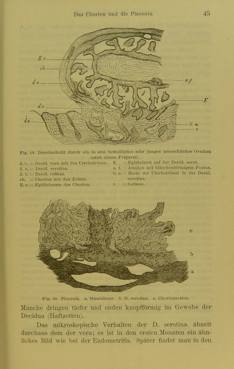 Fig. 19. Durchschiiitt durch eiii in situ befindliches sehr junges menschliches Oviilum (uacli eiuem Praparat). d.v. ^Decid. vera mit denUterindrilsen. E ^Epithelrest aiif der Decid. serot. d. s. =r Decid. serotina. a. f. r= Amnion mit blasclienfermigem Foetus. d. r. zn Decid. reflexa. G. u. z= Reste der Uterindrusen in der Decid. ch. = Cliorioii mit den Zotten. serotina. E. 0. = Epithelsaum des Chorion. V. = Gefasse. Fig. 20. Placenta, a. Musculatiir. lo. D. serotina. c. Chorionzotten. Manche dringen tiefer und enden knopfformig im Gewebe der Decidua (Haftzotten). Das mikroskopische Verhalten der D. serotina ahnelt durchaus dem der vera; es ist in den ersten Monaten ein ahn- liches Bild wie bei der Endometritis. Spilter findet man in den