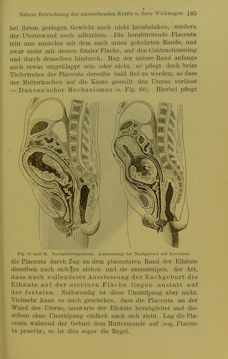 bei ,ihrem g-eringen Gewicht noch niclit herabsinken, sondern der Uteruswand noch adhariren. Die herabtretende Placenta tritt nun zunachst mit dem nach unten gekehrten Rande, und zwar meist mit dessen fotaler Flaclie, auf den Contractionsring- und durch denselben hindurch. Mag- der untere Rand anfangs noch etwas umgeklappt sein oder nicht, so pflegt doch beim Tiefertreten der Placenta derselbe bald frei zu werden, so dass der Mutterkuchen auf die Kante gestellt den Uterus verlasst — Duncan'scher Mechanismus (s. Fig. 60). Hierbei pflegt Fig. Gl und 02. Nachgeburtsperlode. Ausstossung Aev Nachgeburt mit Inversion. die Placenta durch Zug an dem placentaren Rand der Eihaute dieselben nach sichfzu Ziehen und sie umzustulpen, der Art, dass nach vollendeter Ausstossung der Nachgeburt die Eihaute auf der uterinen Fliiche liegen anstatt auf der foetalen. Nothwendig ist diese Umstiilpung aber nicht. Vielmehr kann es auch geschehen, dass die Placenta an der Wand des Uterus, ausvvilrts der Eihaute herabgieitet und die- selben ohne Umsttilpung einfach nach sich zieht. Lag die Pla- centa wahrend der Geburt dem Muttermunde auf (sog. Placen- ta praevia), so ist dies sogar die Regel.