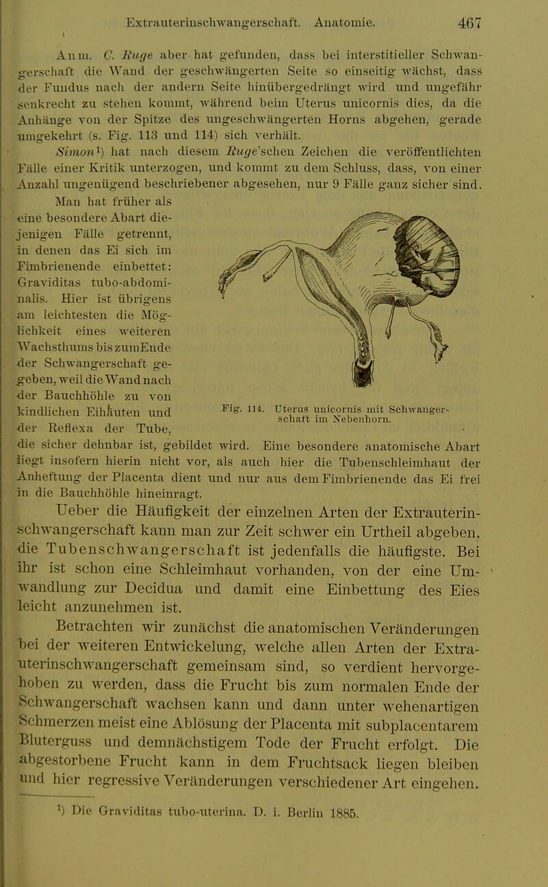 A11 in. C. Ruge aber hat g-efvinden, dass bei interstitieller Schwan- g-ersfhal't die Wand der geschwjlngerten Seite so einseitig wachst, dass der Fundus nach der andern Seite liiniibergedrangt wird und ungefahr senkrecht zu stelien konunt, wahrend beim Uterus unicornis dies, da die Anhiinge von der Spitze des ungeschwangerten Horns abgehen, gerade iimgekehrt (s. Fig. 113 und 114) sich verhiilt. Simon^) hat nach diesem Ruge'sahQw Zeichen die veroffentlichten Falle einer Kritik unterzogen, und kommt zu dem Schluss, dass, von einer Anzahl ungeniigend beschriebener abgesehen, nur 9 Falle ganz sicher sind. Man hat friiher als eine besondere Abart die- jenigen Falle getrennt, in denen das Ei sich im Fimbrienende einbettet: Graviditas tubo-abdomi- nahs. Hier ist iibrigens am leichtesten die Mog- lichkeit eines weiteren VVachsthiims bis zumEnde der Schwangerschaft g-e- ^eben, well die Wand nach der Bauchhohle zu von kindlichen Eihiiuten und Uterus unicornis mit Schwanger- scliatt im Isebenhorn. der Reflexa der Tube, die sicher dehnbar ist, gebildet wird. Eine besondere anatomische Abart diegt insofern hierin nicht vor, als auch hier die Tubenschleimhaut der Anheftung der Placenta dient und nur aus dem Fimbrienende das Ei frei in die Bauchhohle hineinragt. Ueber die Haiifig-keit der einzeliien Arten der Extrauterin- schwangerschaft kann man zur Zeit schwer ein Urtheil abgeben. die Tubenschwangerschaft ist jedenfalls die haiifigste. Bei ihr ist schon eine Schleimhaut vorhanden, von der eine Um- ' wandlimg zur Decidua und damit eine Embettung des Eies leicht anzunehmen ist. Betrachten wir zunachst die anatomischen Verftnderungen hei der weiteren Entwickeking, welche alien Arten der Extra- uterinschwangerschaft gemeinsam sind, so verdient hervorge- hoben zu werden, dass die Frucht bis zum normalen Ende der Schwangerschaft wachsen kann und dann unter wehenartigen Schmerzen meist eine Ablosung der Placenta mit subplaceutarem Bluterguss und demnachstigem Tode der Frucht erfolgt. Die abgestorbene Frucht kann in dem Fruchtsack liegen bleiben und hier regressive Veranderungen verschiedener Art eingehen. Die Graviditas tubo-uterina. D. i. Berlin 1885.