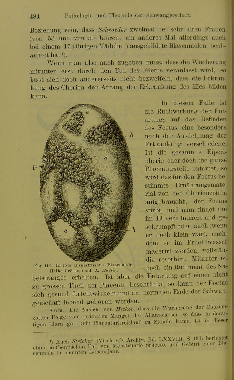 Beziehung sein, dass Schroeder zweimal bei sehr alten Frauen (von 53 unci von oO Jahren, ein anderes Mai allerdings auch bei einem 17 jahrigen Madchen) ausgebildete Blasenmolen beob- achtet hat'). W enn man also auch zugeben muss, dass die Wucherung mitunter erst durch den Tod des Foetus veranlasst wird, so lasst sich doch andererseits nicht bezweifeln, dass die Erkran- kung- des Chorion den Anfang der Erkrankung- des Eies bilden kann. In dlesem Falle ist die Ruckwirkung- der Ent- artung- auf das Befinden des Foetus eine besonders nach der Ausdehnung- der Erkrankung- verschiedene. Ist die g-esammte Eiperi- pherie oder doch die ganze Placentarstelle entartet, so wird das filr den Foetus be- stimmte Ernahrungsmate- rial von den Chorionzotten aufgebraucht, der Foetus stirbt, und man findet ihn im Ei verkiimmert und ge- schrumpft oder auch (wenn er noch klein war), nach- dem er im Fruchtwasser macerirt worden, vollstan- dig resorbirt. Mitunter ist noch ein Rudiment desNa- Fig. 116. In toto aiisgestotiseiie Blasenmole. Halbe GrOsse, nach H. 3Iartin. belstranges erhalten. Ist aber die Entartung auf einen nicht zu gTOSsen Theil der Placenta beschrankt, so kann der Foetus sich gesund fortentwickeln und am normalen Ende der Schwan- gerschaft lebend geboren werden. Anm. Die Ansicht von Hecker, dass die Wuchening der Chorion- zotten Folge voin primHren Mangel der Allantois sci, so dass in derar- tigen Eiern gar kein Placentarkreislauf zu Stande kiinie, ist m dicser 1) Audi Strieker (Vircl.oWs Archiv. Bd. LXXVIIL S 193) bei-icM^^^ einen authentisclien Fall von Menstruatio praecox und Geburt eniei Bla senmole im neunten Lebcnsjahr.