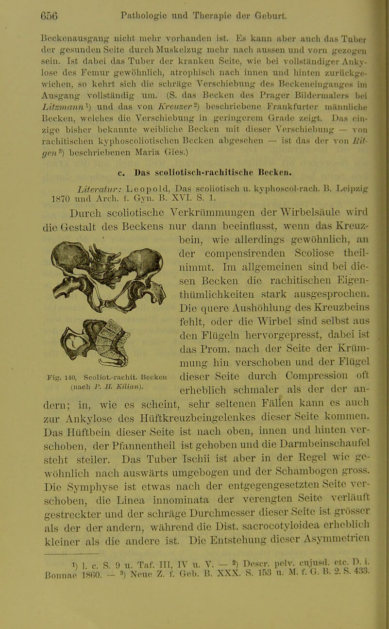 Bockeuausgang' niclit niehr vorliandcn ist. Es kaun aber auch das Tuber dor gesiindcu Scite durch Muskelzug melir iiacli aussen und vorn gezogeu sein. Ist dabei das Tubor der kranken Seite, wio bei vollstUndiger Anky- lose des Fermir gewiHiulicli, atropliiscli nach inncn und hinten zuriickgfi- wichcn, so kehrt sich die schrJlge Vei'schiebung des Beckeneinganges im Ausg-ang vollstilndig um. (S. das Becken des Prager Bildernialers bei Litzmann'^) und das von Kreuzer-) bcscliriebene Frankfurter niannliche Becken, welches die Verscliiebung in geringerem Grade zeigt. Das cin- zige bisher bekannte weibliclie Becken niit dieser Verschiebung ~ von racliitischen kyphoscoliotischen Becken abgesehen — ist das der von iHt- c/en^) beschriebenen Maria Gies.) c. Das scoliotisch-racliitisclie Beckeu. Literatur: Leopold, Das scoliotisch ii. kvphoscol-rach. B. Leipzig 1870 und Arch. t. Gyn. B. XVI. S. 1. Durcli scoliotische Verkriimmungen der Wirbelsiiule wircl die Gestalt des Beckens nur dann beeinflusst, wenn das Kreuz- beiii, wie allerdings gewohiilich, an der compensirenden Scoliose theil- nimrat. Im allgemeinen sind bei die- sen Becken die rachitischen Eigen- thiimlichkeiten stark ausgesprochen. Die quere Aushohlung des Ki'euzbeins felilt, Oder die Wirbel sind selbst aus den Fliigeln hervorgepresst, dabei ist das Prom, nach der Seite der Kriini- mmig liin verschoben mid der Flugel Fig. 140, scoiiot.-rachit. Becken dicscr Scite dm'cli Comprcssion oft (nach i'. JT./um«). erheblicli sclimaler als der der an- dern; in, wie es scheint, selir seltenen Fallen kann es auch ZLir Ankylose des HUftkreuzbeingelenkes dieser Seite kommen. Das Htiftbein dieser Seite ist nach oben, innen und hinten ver- schoben, der Pfannentheil ist gehoben und die Darmbeinschaufel steht steiler. Das Tuber Ischii ist aber in der Kegel wie go- wohnlich nach auswarts umgebogen und der Schambogcn gross. Die Symphyse ist etwas nach der entgegengesetzten Scite ver- schoben, die Linea innominata der verengten Seite verliluft gestreckter und der schrage Durchmesser dieser Seite ist grosser als der der andern, wahrcnd die Dist. sacrocotyloidea erhcblich klciner als die andere ist. Die Entstehung- dieser Asymmetricn 1) 1. c. S. 9 u. Taf. Ill, IV u. V. - 2) Descr. polv cujusd. etc^ DA. Bonnao 1800. - «) Neue Z. I' Geb. B. XXX. R. 153 u. M. f. G. B. 2. S. 433.