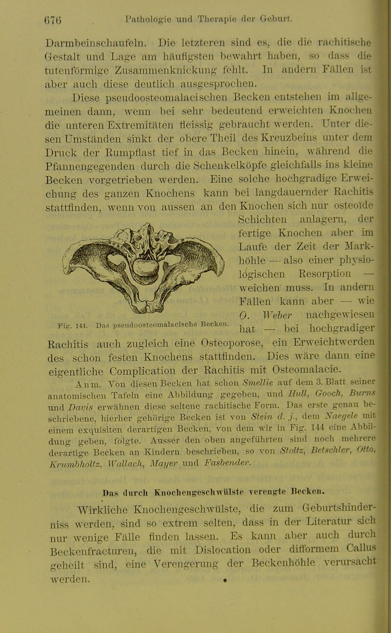 Darmbeinscliaiifeln. Die letzteren sind es, die die rachitische Gestalt iind Lag-e am haufig'sten bcwahrt haben, so dass die tutenformige Zusammenknickung fehlt. In andeni Fallen ist aber audi diese deutlieh ausgesprochen. Diese pseudoosteomalacischen Becken entstehen im allge- meinen dann, wenn bei sehr bedeutend erweichten Knoclien die unteren Extremitaten iieissig gebraucht werden. Unter die- sen Umstanden sinkt der obere Theil des Kreiizbeins unter dem Druck der Rumpflast tief in das Becken hinein, wahi^end die Pfannengeg-enden durcli die Schenkelkopfe gieichfalls ins kleine Becken vorgetrieben werden. Eine solche hochgradige Erwei- chung- des ganzen Knochens kann bei langdauernder Rachitis an den Knoclien sich nur osteolde Scliicliten anlagern, der fertige Knochen aber im Laufe der Zeit der ]\Iark- liolile — also einer physio- logisclien Resorption — weichen muss. In andern Fallen kann aber — wie 0. Weber nacligewiesen hat — bei hochgradiger stattfinden, wenn von aussen Fig. 144. Das pseudoosteomalacische Becken. Rachitis auch zugleich eine Osteoporose, ein Erweichtwerden des schon festen Knochens stattfinden. Dies ware dann erne eig-entliche Complication der Rachitis mit Osteomalacic. Anm. Von diesen Becken hat nchow Smellie auf dem 3. Blatt seiner anatomischen Tafeln eine Abbildung- gegeben, nnd Hull, Gooch, Burns und Davis erwahnen diese seltene rachitische Form. Das erste genau be- schriebene, hierher gehorige Becken ist von Stein d. j., dem Xaegele rait einem exquisiten derartigen Becken, von dem wir in Fig. 144 eine Abbil- dung- ^eben, folgte. Ausser den oben ang-efiihrten sind noch mehrere derartige Becken an Kindern beschrieben, so von Sfoltz, BetscMer, Otto, KrumhhoUz, Wallach, Mayer und Fasbender. Das (lurch Kuocliengeschwulste vereiigte Becken. Wirkliche Knochengeschwiilste, die zum Geburtshmder- niss werden, sind so extrem selten, dass in der Literatur sich nur wenige Falle finden lassen. Es kann aber auch durch Beckenfracturen, die mit Dislocation oder difformem Callus geheilt sind, eine Verengerung der Beckenhohle verursacht werden. •