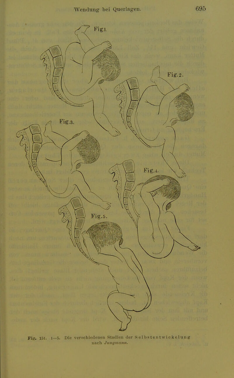 Fig. 151. 1—>• Die verschicdcnen Stadien der S e 1 b s t e ii t w i f-k e 1 u ii g iincli Jtingmann.