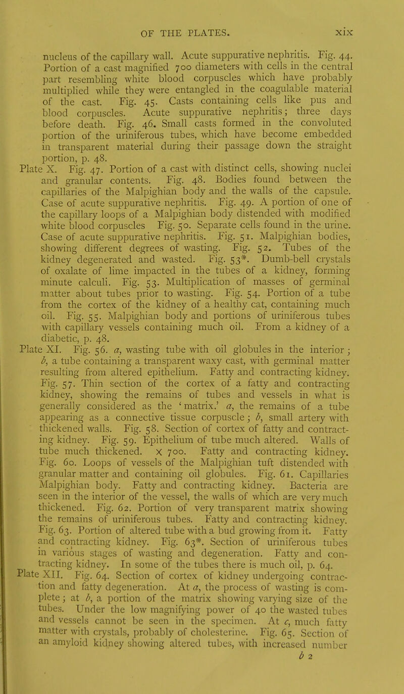 nucleus of the capillary wall. Acute suppurative nephritis. Fig. 44. Portion of a cast maguified 700 diameters with cells in the central part resembling white blood corpuscles which have probably multiplied while they were entangled in the coagulable material of the cast. Fig. 45. Casts containing cells like pus and blood corpuscles. Acute suppurative nephritis; three days before death. Fig. 46. Small casts formed in the convoluted portion of the uriniferous tubes, which have become embedded in transparent material during their passage down the straight portion, p. 48. Plate X. Fig. 47. Portion of a cast with distinct cells, showing nuclei and granular contents. Fig. 48. Bodies found between the capillaries of the Malpighian body and the walls of the capsule. Case of acute suppurative nephritis. Fig. 49. A portion of one of the capillary loops of a Malpighian body distended with modified white blood corpuscles Fig. 50. Separate cells found in the urine. Case of acute suppurative nephritis. Fig. 51. Malpighian bodies, showng different degrees of wasting. Fig. 52. Tubes of the kidney degenerated and wasted. Fig. 53*. Dumb-bell crystals of oxalate of hme impacted in the tubes of a kidney, forming minute calculi. Fig. 53. Multiplication of masses of germinal matter about tubes prior to wasting. Fig. 54. Portion of a tube from the cortex of the kidney of a healthy cat, containing much oil. Fig. 55. Malpighian body and portions of uriniferous tubes with capillary vessels containing much oil. From a kidney of a diabetic, p. 48. Plate XI. Fig. 56. wasting tube with oil globules in the interior; a tube containing a transparent waxy cast, with germinal matter resulting from altered epithelium. Fatty and contracting kidney. Fig. 57. Thin section of the cortex of a fatty and contracting kidney, showing the remains of tubes and vessels in what is generally considered as the ' matrix,' a, the remains of a tube appearing as a connective tissue corpuscle; b, small artery with thickened walls. Fig. 58. Section of cortex of fatty and contract- ing kidney. Fig. 59. Epithelium of tube much altered. Walls of tube much thickened. X 700. Fatty and contracting kidney. Fig. 60. Loops of vessels of the Malpighian tuft distended with granular matter and containing oil globules. Fig. 61. Capillaries Malpighian body. Fatty and contracting kidney. Bacteria are seen in the interior of the vessel, the walls of which are very much thickened. Fig. 62. Portion of very transparent matrix showing the remains of uriniferous tubes. Fatty and contracting kidney. Fig. 63. Portion of altered tube with a bud growing from it. Fatty and contracting kidney. Fig. 63*. Section of uriniferous tubes in various stages of wasting and degeneration. Fatty and con- tracting kidney. In some of the tubes there is much oil, p. 64. Plate XII. Fig. 64. Section of cortex of kidney undergoing contrac- tion and fatty degeneration. At the process of wasting is com- plete ; at a portion of the matrix showing varying size of the tubes. Under the low magnifying power of 40 the wasted tubes and vessels cannot be seen in the specimen. At much fatty matter with crystals, probably of cholesterine. Fig. 65. Section of an amyloid kidney showing altered tubes, with increased number b 2