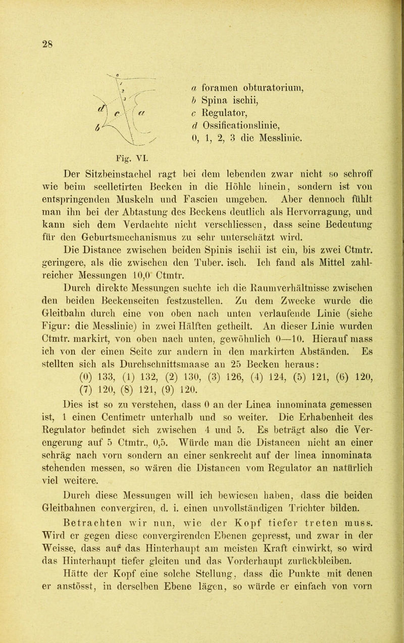 a foramen obtiiratoriiim, h Spina ischii, c Kegulator, ä Ossificationslinie, 0, 1, % 3 die Messlinie. Der Sitzbeinstachel ragt bei dem lebenden zwar nicht so schroff wie beim scelletirten Becken in die Höhle hinein, sondern ist von entspringenden Muskeln und Fascien umgeben. Aber dennoch fühlt man ihn bei der Abtastung des Beckens deutlich als Hervorragung, und kann sich dem Verdachte nicht verschliessen, dass seine Bedeutung für den Geburtsmechanismus zu sehr unterschätzt wird. Die Distance zwischen beiden Spinis ischii ist ein, bis zwei Ctmtr. geringere, als die zwischen den Tuber, isch. Ich fand als Mittel zahl- reicher Messungen 10,0 Ctmtr. Durch direkte Messungen suchte ich die Raumverhältnisse zwischen den beiden Beckenseiten festzustellen. Zu dem Zwecke wurde die Gleitbahn durch eine von oben nach unten verlaufende Linie (siehe Figur: die Messlinie) in zwei Hälften getheilt. An dieser Linie wurden Ctmtr. markirt, von oben nach unten, gewöhnlich 0—10. Hierauf mass ich von der einen Seite zur andern in den markirten Abständen. Es stellten sich als Durchschnittsmaase an 25 Becken heraus: (0) 133, (1) 132, (2) 130, (3) 126, (4) 124, (5) 121, (6) 120, (7) 120, (8) 121, (9) 120. Dies ist so zu verstehen, dass 0 an der Linea innominata gemessen ist, 1 einen Centimetr unterhalb und so weiter. Die Erhabenheit des Regulator befindet sich zwischen 4 und 5. Es beträgt also die Ver- engerung auf 5 Ctmtr., 0,5. Würde man die Distancen nicht an einer schräg nach vorn sondern an einer senkrecht auf der linea innominata stehenden messen, so wären die Distancen vom Regulator an natürlich viel weitere. Durch diese Messungen will ich bewiesen haben, dass die beiden Gleitbahnen convergiren, d. i. einen unvollständigen Trichter bilden. Betrachten wir nun, wie der Kopf tiefer treten muss. Wird er gegen diese convergirenden Ebenen gepresst, und zwar in der Weisse, dass auf das Hinterhaupt am meisten Kraft ein wirkt, so wird das Hinterhaupt tiefer gleiten und das Vorderhaupt Zurückbleiben. Hätte der Kopf eine solche Stellung, dass die Punkte mit denen er anstösst, in derselben Ebene lägen, so würde er einfach von vorn Fig. VI.