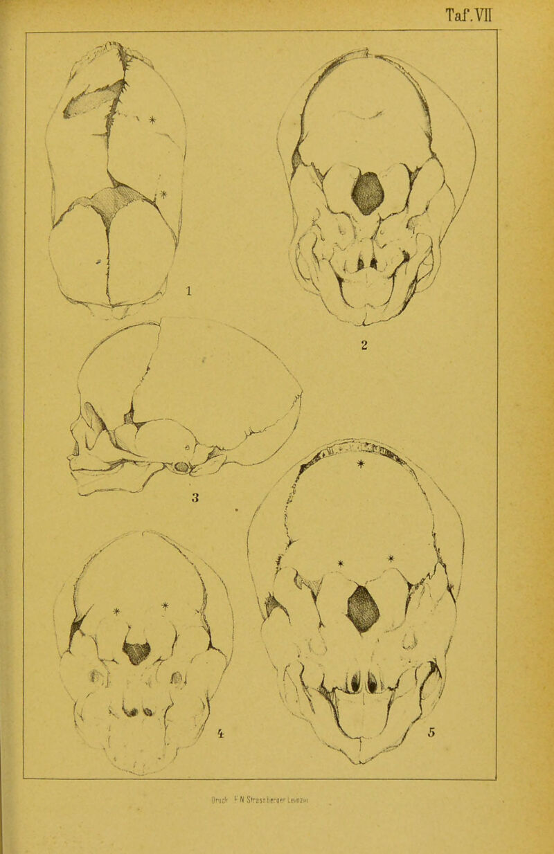 Tai-.VII Onic'' !■ N Strssrneroe' Lfinzia