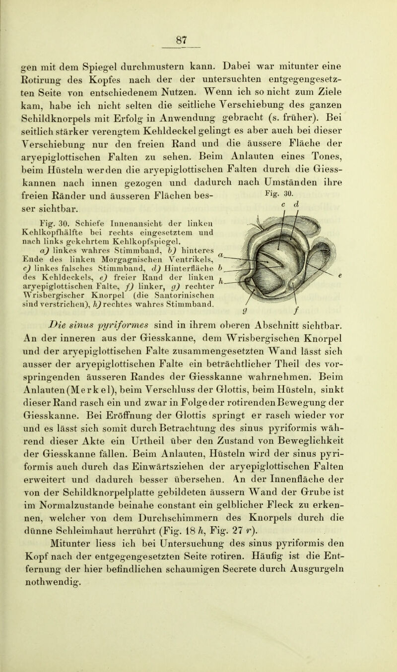 gen mit dem Spiegel durchmustern kann. Dabei war mitunter eine Rotirung des Kopfes nach der der untersuchten entgegengesetz- ten Seite von entschiedenem Nutzen. Wenn ich so nicht zum Ziele kam, habe ich nicht selten die seitliche Verschiebung des ganzen Schildknorpels mit Erfolg in Anwendung gebracht (s. früher). Bei seitlich stärker verengtem Kehldeckel gelingt es aber auch bei dieser Verschiebung nur den freien Rand und die äussere Fläche der aryepiglottischen Falten zu sehen. Beim Anlauten eines Tones, beim Hüsteln werden die aryepiglottischen Falten durch die Giess- kannen nach innen gezogen und dadurch nach Umständen ihre freien Ränder und äusseren Flächen bes- Fls- 30- ser sichtbar. Fig. 30. Schiefe Innenansicht der linken Kehlkopfhälfte bei rechts eingesetztem und nach links gekehrtem Kehlkopfspiegel. a) linkes wahres Stimmband, b) hinteres Ende des linken Morgagnischen Ventrikels, c) linkes falsches Stimmband, d) Hinterfläche b des Kehldeckels, e) freier Rand der linken aryepiglottischen Falte, f) linker, g) rechter Wrisbergischer Knorpel (die Santorinischen sind verstrichen), /^rechtes wahres Stimmband. Die sinus pyriformes sind in ihrem oberen Abschnitt sichtbar. An der inneren aus der Giesskanne, dem Wrisbergischen Knorpel und der aryepiglottischen Falte zusammengesetzten Wand lässt sich ausser der aryepiglottischen Falte ein beträchtlicher Theil des vor- springenden äusseren Randes der Giesskanne wahrnehmen. Beim Anlauten (Me r k el), beim Verschluss der Glottis, beim Hüsteln, sinkt dieser Rand rasch ein und zwar in Folge der rotirenden Bewegung der Giesskanne. Bei Eröffnung der Glottis springt er rasch wieder vor und es lässt sich somit durch Betrachtung des sinus pyriformis wäh- rend dieser Akte ein Urtheil über den Zustand von Beweglichkeit der Giesskanne fällen. Beim Anlauten, Hüsteln wird der sinus pyri- formis auch durch das Einwärtsziehen der aryepiglottischen Falten erweitert und dadurch besser übersehen. An der Innenfläche der von der Schildknorpelplatte gebildeten äussern Wand der Grube ist im Normalzustande beinahe constant ein gelblicher Fleck zu erken- nen, welcher von dem Durchschimmern des Knorpels durch die dünne Schleimhaut herrührt (Fig. 18 Fig. 27 r). Mitunter liess ich bei Untersuchung des sinus pyriformis den Kopf nach der entgegengesetzten Seite rotiren. Häufig ist die Ent- fernung der hier befindlichen schaumigen Secrete durch Ausgurgeln nothwendig.