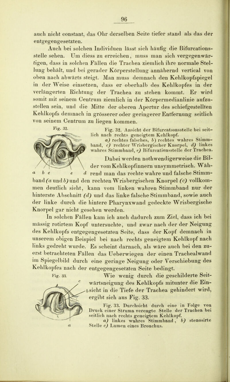 auch nicht constant, das Ohr derselben Seite tiefer stand als das der entgegengesetzten. Auch bei solchen Individuen lässt sich häufig die Bifurcations- stelle sehen. Um diess zu erreichen, muss man sich vergegenwär- tigen, dass in solchen Fällen die Trachea ziemlich ihre normale Stel- lung behält, und bei gerader Körperstellung annähernd vertical von oben nach abwärts steigt. Man muss demnach den Kehlkopfspiegel in der Weise einsetzen, dass er oberhalb des Kehlkopfes in der verlängerten Richtung der Trachea zu stehen kommt. Er wird somit mit seinem Centrum ziemlich in der Körpermedianlinie aufzu- stellen sein, und die Mitte der oberen Apertur des schiefgestellten Kehlkopfs demnach in grösserer oder geringerer Entfernung seitlich von seinem Centrum zu liegen kommen. Fl&- 32- Fig. 32. Ansicht der Bifurcationsstelle bei seit- lich nach rechts geneigtem Kehlkopf. a) rechtes falsches, b) rechtes wahres Stinini- band, c) rechter Wrisbergischer Knorpel, d) linkes wahres Stinimband, e) Bifurcationsstelle der Trachea. Dabei werden nothwendigerweise die Bil- der vom Kehlkopfinnern unsymmetrisch. Wäh- a & c e d rend man das rechte wahre und falsche Stimm- band Ca und b) und den rechten Wrisbergischen Knorpel (c) vollkom- men deutlich sieht, kann vom linken wahren Stimmband nur der hinterste Abschnitt (dj und das linke falsche Stimmband, sowie auch der linke durch die hintere Pharynxwand gedeckte Wrisbergische Knorpel gar nicht gesehen werden. In solchen Fällen kam ich auch dadurch zum Ziel, dass ich bei mässig rotirtem Kopf untersuchte, und zwar nach der der Neigung des Kehlkopfs entgegengesetzten Seite, dass der Kopf demnach in unserem obigen Beispiel bei nach rechts geneigtem Kehlkopf nach links gedreht wurde. Es scheint darnach, als wäre auch bei den zu- erst betrachteten Fällen das Ueberwiegen der einen Trachealwand im Spiegelbild durch eine geringe Neigung oder Verschiebung des Kehlkopfes nach der entgegengesetzten Seite bedingt. Fig. 33. Wie wenig durch die geschilderte Seit- wärtsneigung des Kehlkopfs mitunter die Ein- sicht in die Tiefe der Trachea gehindert wird, ergibt sich aus Fig. 33. Fig. 33. Durchsicht durch eine in Folge von Druck einer Struma verengte Stelle der Trachea bei seitlich nach rechts geneigtem Kehlkopf. a) linkes wahres Stimmband, b) stenosirte a Stelle c) Lumen eines Bronchus.