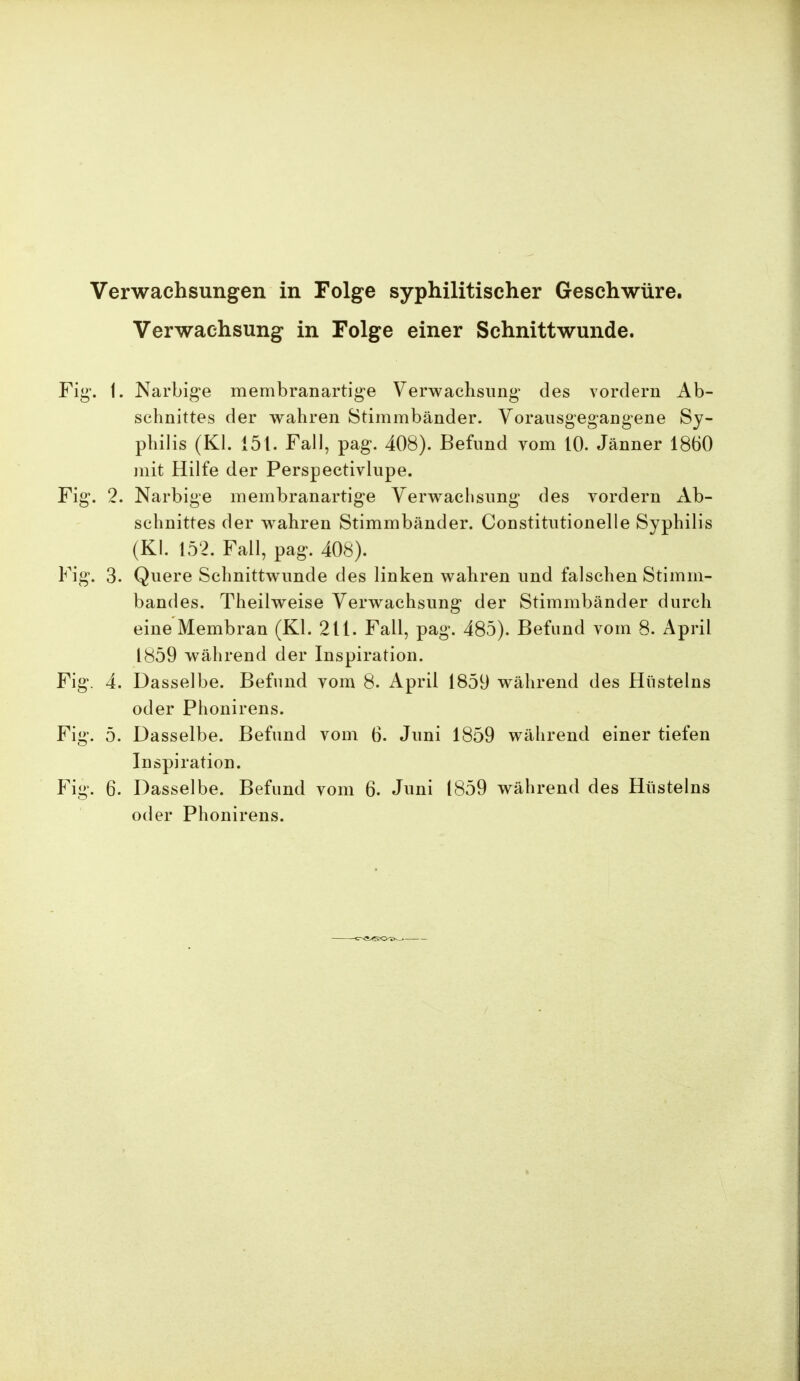 Verwachsungen in Folge syphilitischer Geschwüre. Verwachsung in Folge einer Schnittwunde. Fig. 1. Narbige membranartige Verwachsung* des vordem Ab- schnittes der wahren Stimmbänder. Vorausgegangene Sy- philis (Kl. 151. Fall, pag. 408). Befund vom 10. Jänner 1860 mit Hilfe der Perspectivlupe. Fig. 2. Narbige membranartige Verwachsung des vordem Ab- schnittes der wahren Stimmbänder. Constitiitionelle Syphilis (Kl. 152. Fall, pag. 408). Fig. 3. Quere Schnittwunde des linken wahren und falschen Stimm- bandes. Theilweise Verwachsung der Stimmbänder durch eine Membran (Kl. 211. Fall, pag. 485). Befund vom 8. April 1859 während der Inspiration. Fig. 4. Dasselbe. Befund vom 8. April 1859 während des Hüsteins oder Phonirens. Fig. 5. Dasselbe. Befund vom 6. Juni 1859 während einer tiefen Inspiration. Fig. 6. Dasselbe. Befund vom 6. Juni 1859 während des Hüsteins oder Phonirens.