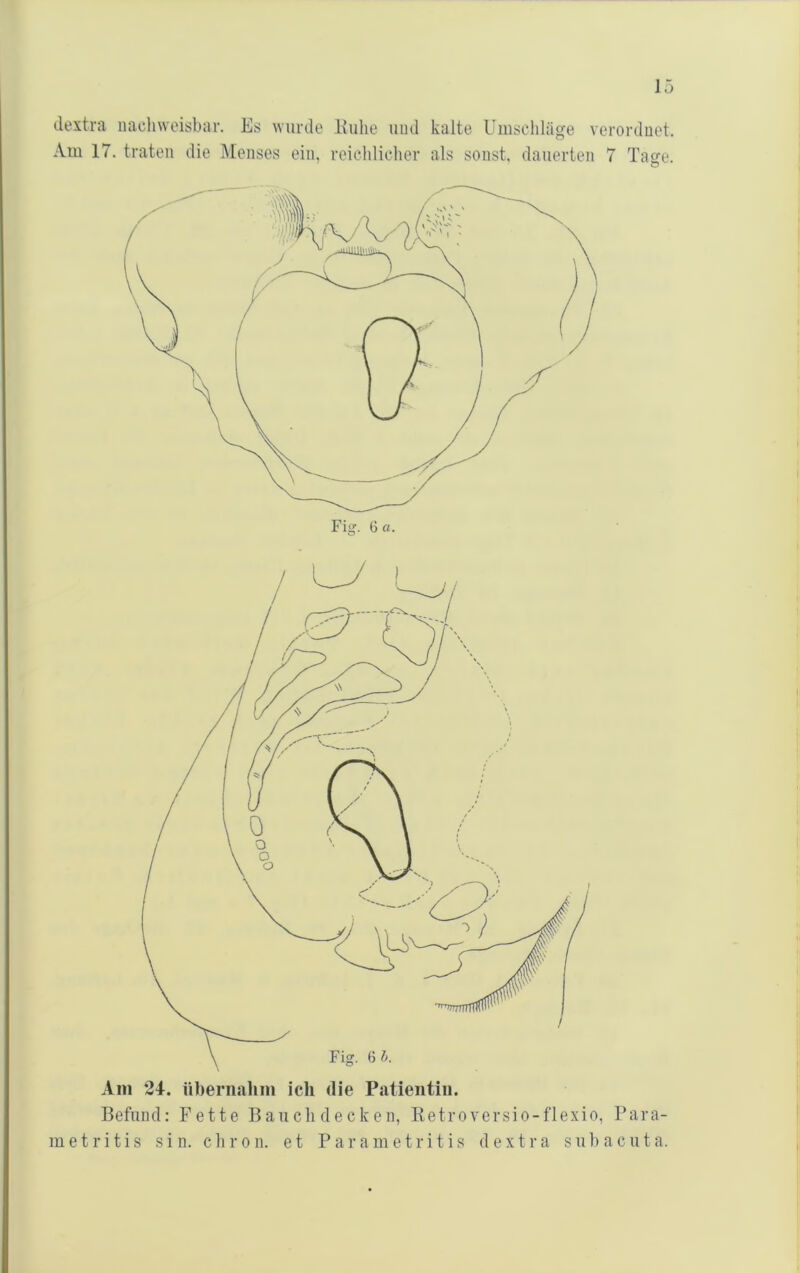 clextra nacliweisbar. Es wurde Eulie uud kalte Umschläge verordnet. Am 17. traten die Menses ein, reichliclier als sonst, dauerten 7 Tage. Befund: Fette Baucli decken, Ketroversio-flexio, Para- metritis sin. chron. et Parametritis dextra subacuta.