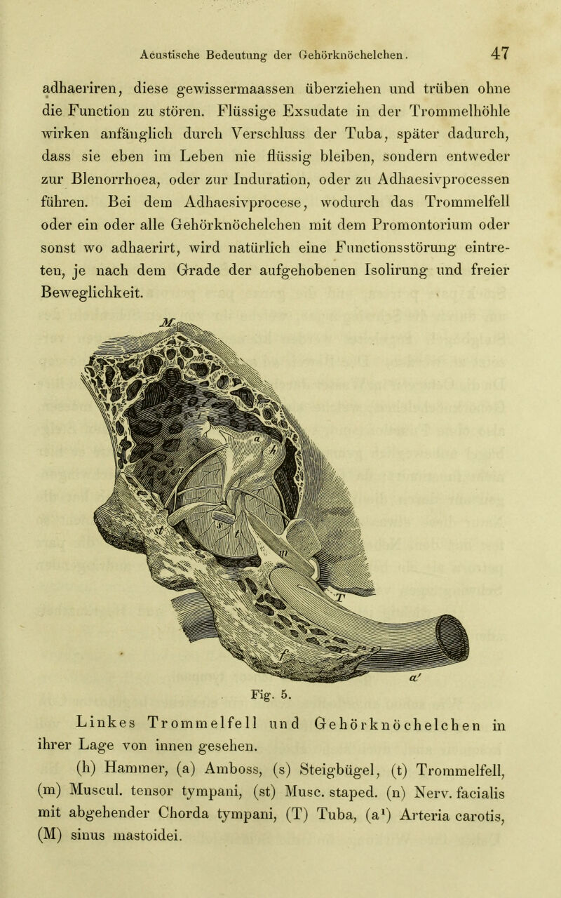 adhaeriren, diese gewissermaassen überziehen und trüben ohne die Function zu stören. Flüssige Exsudate in der Trommelhöhle wirken anfänglich durch Verschluss der Tuba^ später dadurch, dass sie eben im Leben nie flüssig bleiben, sondern entweder zur Blenorrhoea, oder zur Induration, oder zu Adhaesivprocessen führen. Bei dem Adhaesivprocese, wodurch das Trommelfell oder ein oder alle Gehörknöchelchen mit dem Promontorium oder sonst wo adhaerirt, wird natürlich eine Functionsstörung eintre- ten, je nach dem Grade der aufgehobenen Isolirung und freier Beweglichkeit. Fig. 5. Linkes Trommelfell und Gehörknöchelchen in ihrer Lage von innen gesehen. (h) Hammer, (a) Amboss, (s) Steigbügel, (t) Trommelfell, (m) Muscul. tensor tympani, (st) Muse, staped. (n) Nerv, facialis mit abgehender Chorda tympani, (T) Tuba, (a») Arteria carotis, (M) sinus mastoidei.