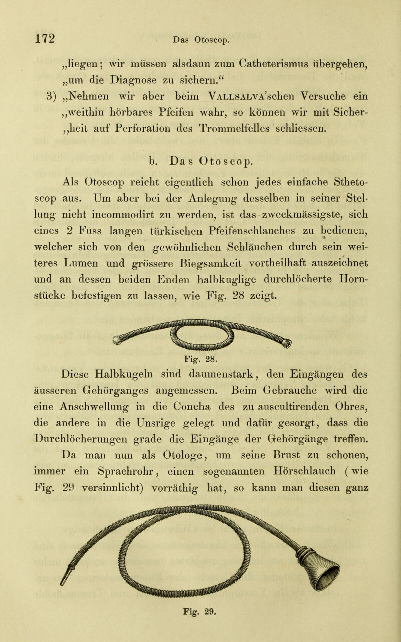 „liegen; wir müssen alsdaun zum Catheterismus übergehen, „um die Diagnose zu sichern/^ 3) „Nehmen wir aber beim VALLSALVA'schen Versuche ein j,weithin hörbares Pfeifen wahr, so können wir mit Sicher- ,,heit auf Perforation des Trommelfelles schliessen. b. Da s Otoscop. Als Otoscop reicht eigentlich schon jedes einfache Stheto- scop aus. Um aber bei der Anlegung desselben in seiner Stel- lung nicht incommodirt zu werden, ist das zweckmässigste, sich eines 2 Fuss langen türkischen Pfeifenschlauches zu bedienen, welcher sich von den gewöhnlichen Schläuchen durch sein wei- teres Lumen und grössere Biegsamkeit vortheilhaft auszeichnet und an dessen beiden Enden halbkuglige durchlöcherte Horn- stücke befestigen zu lassen, wie Fig. 28 zeigt. Fig. 28. Diese Halbkugeln sind daumenstark, den Eingängen des äusseren Gehörganges angemessen. Beim Gebrauche wird die eine Anschwellung in die Concha des zu auscultirenden Ohres, die andere in die Unsrige gelegt und dafür gesorgt, dass die Durchlöcherungen grade die Eingänge der Gehörgänge treffen. Da man nun als Otologe, um seine Brust zu schonen, immer ein Sprachrohr, einen sogenannten Hörschlauch (wie Fig. 29 versinnlicht) vorräthig hat, so kann man diesen ganz Fig. 29.