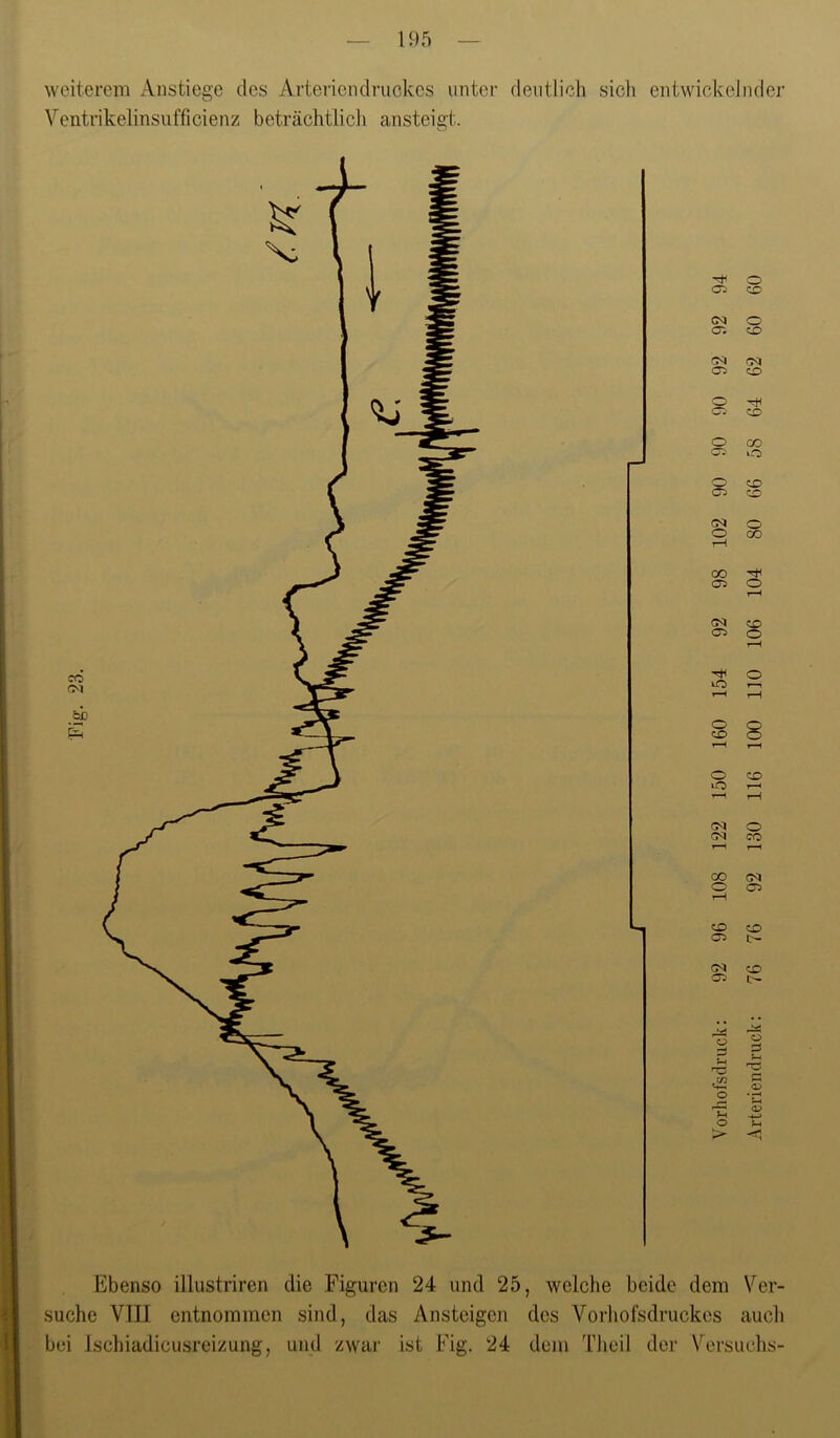 weiterem Anstiege des Arterienclruckes unter deutlich sich entwickelnder Ventrikelinsufficienz beträchtlich ansteigt. Ebenso illustriren die Figuren 24 und 25, welche beide dem Ver- suche VIII entnommen sind, das Ansteigen des Vorhofsdruckes auch bei Ischiadicusreizung, und zwar ist Fig. 24 dem Theil der Versuchs-