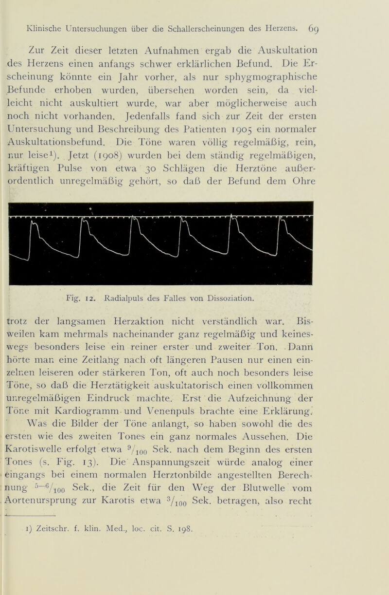 Zur Zeit dieser letzten Aufnahmen ergab die Auskultation des Herzens einen anfangs schwer erklärlichen Befund. Die Er- scheinung könnte ein Jahr vorher, als nur sphygmographische Befunde erhoben wurden, übersehen worden sein, da viel- leicht nicht auskultiert wurde, war aber möglicherweise auch noch nicht vorhanden. Jedenfalls fand sich zur Zeit der ersten Untersuchung und Beschreibung des Patienten 1905 ein normaler Auskultationsbefund. Die Töne waren völlig regelmäßig, rein, nur leise1). Jetzt (1908) wurden bei dem ständig regelmäßigen, kräftigen Pulse von etwa 30 Schlägen die Herztöne außer- ordentlich unregelmäßig gehört, so daß der Befund dem Ohre Fig. 12. Radialpuls des Falles von Dissoziation. trotz der langsamen Herzaktion nicht verständlich war. Bis- weilen kam mehrmals nacheinander ganz regelmäßig und keines- wegs besonders leise ein reiner erster und zweiter Ton. Dann hörte man eine Zeitlang nach oft längeren Pausen nur einen ein- zelnen leiseren oder stärkeren Ton, oft auch noch besonders leise Töne, so daß die Herztätigkeit auskultatorisch einen vollkommen unregelmäßigen Eindruck machte. Erst die Aufzeichnung der Töne mit Kardiogramm und Venenpuls brachte eine Erklärung. Was die Bilder der Töne anlangt, so haben sowohl die des ersten wie des zweiten Tones ein ganz normales Aussehen. Die Karotiswelle erfolgt etwa 9/10o Sek. nach dem Beginn des ersten Tones (s. Fig. 13). Die Anspannungszeit würde analog einer eingangs bei einem normalen Herztonbilde angestellten Berech- nung 5—6/ioo Sek., die Zeit für den Weg der Blutwelle vom Aortenursprung zur Karotis etwa 3/100 Sek. betragen, also recht 1) Zeitschr. f. klin. Med., loc. cit. S. 198.
