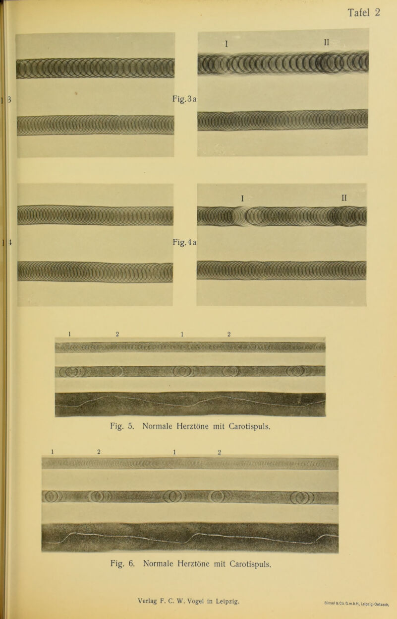 12 12 Fig. 5. Normale Herztöne mit Carotispuls. 12 12 Fig. 6. Normale Herztöne mit Carotispuls.