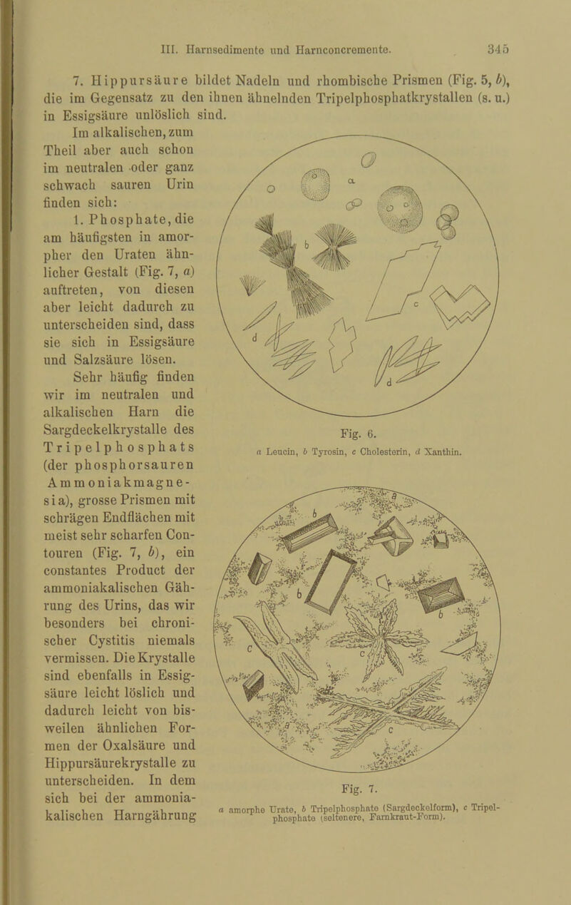 7. Hippursäure bildet Nadeln und rhombische Prismen (Fig. 5, ä), die im Gegensatz zu den ihnen ähnelnden Tripelphosphatkrystallen (s. u.) in Essigsäure unlöslich sind. Im alkalischen, zum Theil aber auch schon im neutralen -oder ganz schwach sauren Urin finden sich: 1. Phosphate, die am häufigsten in amor¬ pher den Uraten ähn¬ licher Gestalt (Fig. 7, a) auftreten, von diesen aber leicht dadurch zu unterscheiden sind, dass sie sich in Essigsäure und Salzsäure lösen. Sehr häufig finden wir im neutralen und alkalischen Harn die Sargdeckelkrystalle des Tripelphosphats „ Leucin, b Tyrosin, c Cholesterin, d Xanthin. (der phosphorsauren Ammoniakmagne¬ sia), grosse Prismen mit schrägen Endflächen mit meist sehr scharfen Con- touren (Fig. 7, ä), ein constantes Product der ammoniakalischen Gäh- rung des Urins, das wir besonders bei chroni¬ scher Cystitis niemals vermissen. DieKrystalle sind ebenfalls in Essig¬ säure leicht löslich und dadurch leicht von bis¬ weilen ähnlichen For¬ men der Oxalsäure und Hippursäurekrystalle zu unterscheiden. In dem sich bei der ammonia¬ kalischen Harngährung Fig. 7. a amorphe Urate, b Tripelphosphato (Sargdechelform), c Tripel¬ phosphate iseltenere, Farnkraut-Form).