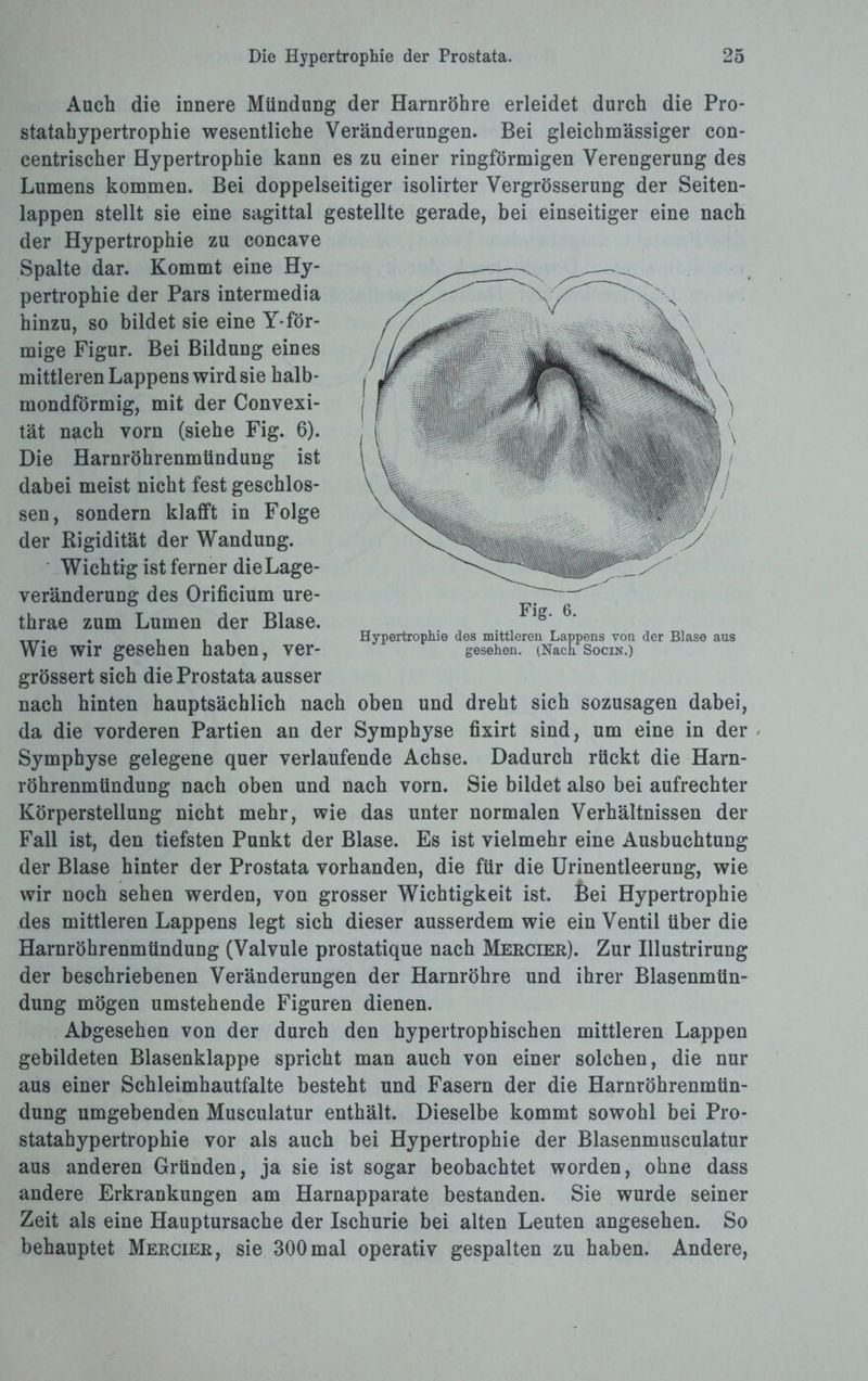 Auch die innere Mündung der Harnröhre erleidet durch die Pro¬ statahypertrophie wesentliche Veränderungen. Bei gleichmässiger eon¬ centrischer Hypertrophie kann es zu einer ringförmigen Verengerung des Lumens kommen. Bei doppelseitiger isolirter Vergrösserung der Seiten¬ lappen stellt sie eine sagittal gestellte gerade, bei einseitiger eine nach der Hypertrophie zu concave Spalte dar. Kommt eine Hy¬ pertrophie der Pars intermedia hinzu, so bildet sie eine Y-för¬ mige Figur. Bei Bildung eines mittleren Lappens wird sie halb¬ mondförmig, mit der Convexi- tät nach vorn (siehe Fig. 6). Die Harnröhrenmündung ist dabei meist nicht fest geschlos¬ sen, sondern klafft in Folge der Rigidität der Wandung. Wichtig ist ferner die Lage¬ veränderung des Orificium ure- thrae zum Lumen der Blase. Wie wir gesehen haben, ver- grössert sich die Prostata ausser nach hinten hauptsächlich nach oben und dreht sich sozusagen dabei, da die vorderen Partien an der Symphyse fixirt sind, um eine in der Symphyse gelegene quer verlaufende Achse. Dadurch rückt die Harn¬ röhrenmündung nach oben und nach vorn. Sie bildet also bei aufrechter Körperstellung nicht mehr, wie das unter normalen Verhältnissen der Fall ist, den tiefsten Punkt der Blase. Es ist vielmehr eine Ausbuchtung der Blase hinter der Prostata vorhanden, die für die Urinentleerung, wie wir noch sehen werden, von grosser Wichtigkeit ist. 6ei Hypertrophie des mittleren Lappens legt sich dieser ausserdem wie ein Ventil über die Harnröhrenmündung (Valvule prostatique nach Mercier). Zur Illustrirung der beschriebenen Veränderungen der Harnröhre und ihrer Blasenmün¬ dung mögen umstehende Figuren dienen. Abgesehen von der durch den hypertrophischen mittleren Lappen gebildeten Blasenklappe spricht man auch von einer solchen, die nur aus einer Schleimhautfalte besteht und Fasern der die Harnröhrenmün¬ dung umgebenden Musculatur enthält. Dieselbe kommt sowohl bei Pro¬ statahypertrophie vor als auch bei Hypertrophie der Blasenmusculatur aus anderen Gründen, ja sie ist sogar beobachtet worden, ohne dass andere Erkrankungen am Harnapparate bestanden. Sie wurde seiner Zeit als eine Hauptursache der Ischurie bei alten Leuten angesehen. So behauptet Mercier, sie 300mal operativ gespalten zu haben. Andere, Fig. 6. Hypertrophie des mittleren Lappens von der Blase aus gesehen. (Nach Socin.)