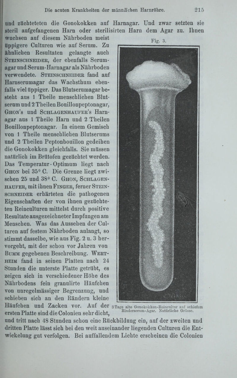 und züchteteten die Gonokokken auf Harnagar. Und zwar setzten sie steril aufgefangenen Harn oder sterilisirten Harn dem Agar zu. Ihnen wuchsen auf diesem Nährboden meist Fia 3 üppigere Culturen wie auf Serum. Zu ähnlichen Resultaten gelangte auch Steinschneider, der ebenfalls Serum¬ agar und Serum-Harnagar als Nährboden verwendete. Steinschneider fand auf Harnserumagar das Wachsthum eben¬ falls viel üppiger. Das Blutserumagar be¬ steht aus 1 Theile menschlichen Blut¬ serum und 2 Theilen Bouillonpeptonagar, Ghon’s und Schlagenhaufer’s Harn¬ agar aus 1 Theile Harn und 2 Theilen Bouillonpeptonagar. In einem Gemisch von 1 Theile menschlichen Blutserums und 2 Theilen Peptonbouillon gedeihen die Gonokokken gleichfalls. Sie müssen natürlich im Brütofen gezüchtet werden. Das Temperatur-Optimum liegt nach Ghon bei 35° C. Die Grenze liegt zwi¬ schen 25 und 38° C. Ghon, Schlagen- haufer, mit ihnen Finger, ferner Stein¬ schneider erhärteten die pathogenen Eigenschaften der von ihnen gezüchte¬ ten Reinculturen mittelst durch positive Resultate ausgezeichneter Impfungen am Menschen. Was das Aussehen der Cul¬ turen auf festem Nährboden anlangt, so stimmt dasselbe, wie aus Fig. 2 u. 3 her¬ vorgeht, mit der schon vor Jahren von Bumm gegebenen Beschreibung. Wert¬ heim fand in seinen Platten nach 24 Stunden die unterste Platte getrübt, es zeigen sich in verschiedener Höhe des Nährbodens fein granulirte Häufchen von unregelmässiger Begrenzung, und schieben sich an den Rändern kleine Häufchen und Zacken vor. Auf der 3Tage alte Gonokokken-Reincultur auf schiefem ersten Platte sind die Colonien sehr dicht, EiIlder8erum-Agar- Na,Miche öriiss0' und tritt nach 48 Stunden schon eine Rückbildung ein, auf der zweiten und dritten Platte lässt sich bei den weit auseinander liegenden Culturen die Ent¬ wickelung gut verfolgen. Bei auffallendem Lichte erscheinen die Colonien