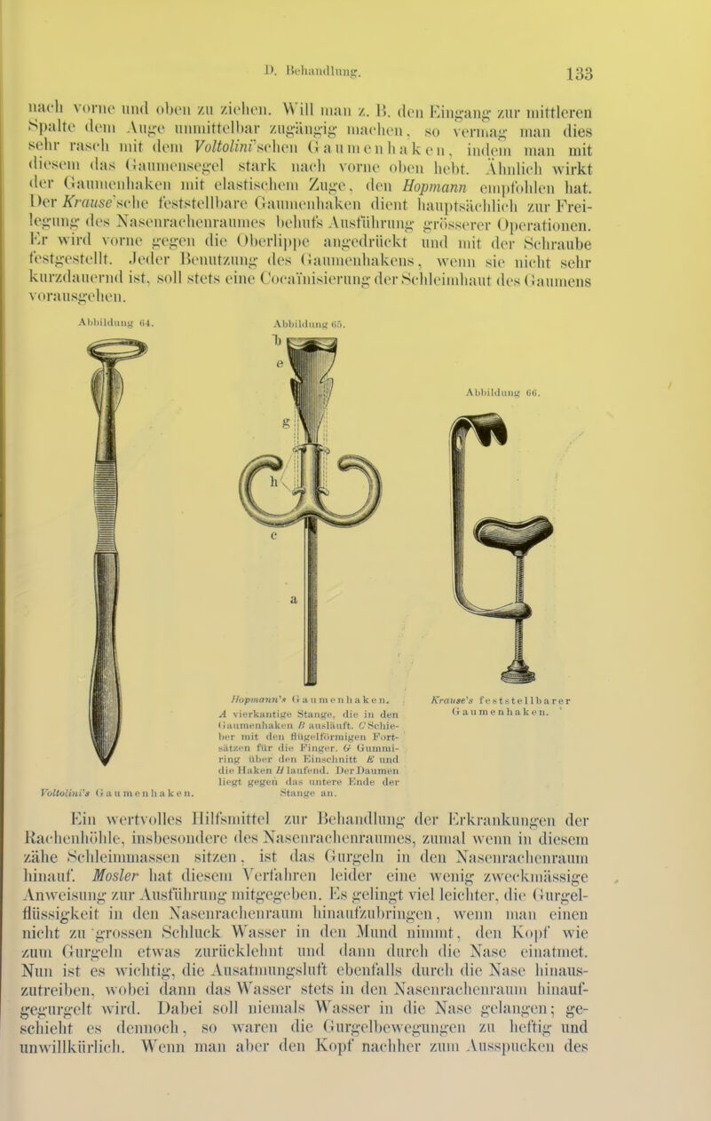 uacli vonio und oben zu /ieheii. Will man /.. U. den Ein^-ano- /ur mittleren Spalte dem Au^-e unmittelbar zui;-iini;-ii;- machen, so verma<^- man dies sehr rasch mit dem Voltolini^nAwn (J au nien h ak en , indem man mit diesem das (Janmensci;-el stark nach vorne oben hebt. Ähnlich wirkt der (iaumenhaken mit elastischem Zu«;e, den Hopmann empfohlen hat. Der Ä'mi/sesche feststellbare Oaumenhaken dient hauptsächlich zur Frei- leii-un«? des Nasenrachenraumes behufs Ansführuni;- i;'r()sserer Operationen. Er wird vorne ^-ei^-en die ()})erlip))e ani;-edrlickt und mit der Schraube festii-estellt. Jeder Benutzung- des (Jaumenliakens, wenn sie nicht sehr kurzdauernd ist, soll stets eine Cocainisieruui;'der Schleimhaut des (iaumens voraus^'ehen. Al)l)il(liiim- (i4. Al)l)il<luii'^ Ii'). .MjliiUlmit; Uli. Voltolini's (lau in e ii Ii a k i' ii. Ilopmann^i (1 a ii m e ii Ii a k e ti. A vierkantiKB Stange, die in den (laiimenliakt'n /? ari.sUuit't. 6'Scliie- lier mit den HiificlfVirniigen Fort- sätzen für die Kinger. O- Gummi- ring über den Kiiisclinitt &' und die Haken //laufend. Derüaumen liegt gegen das untere lOnde der Stangi^ an. Krause's feststellbarer (iaumenhaken. Ein wertvolles Hilfsmittel zur Behamllung- der Erkrankuni^-en der Kachenhöhle, insbesondere des Nasenraclienraumes, zumal wenn in diesem zähe Schleinmiassen sitzen, ist das Gurg-eln in den Nasenrachenraum liinauf. Mosler hat diesem Verfahren leider eine wenig zweckmässige xVnweisung- zur Ausfüiu-ung- mitgegeben. Es gelingt viel leichter, die Gurgel- fiiissigkeit in den Nasenrachenraum hinaiifzul»ringen, wenn man einen nicht zu grossen Schluck Wasser in den Mund ninnnt, den Kopf wie zum Gurgeln etwas zurücklehnt und dann durch die Nase einatmet. Nun ist es wichtig, die Ausatmungsluft ebenfalls durch die Nase hinaus- zutreiben, wobei dann das Wasser stets in den Nasenrachenraum liinauf- gegurgelt wird. Dabei soll niemals Wasser in die Nase gelangen; ge- schieht es dennoch, so waren die Gurgelbewegungen zu heftig und unwillkürlich. Wenn man aber den Kopf nachher zum Ausspucken des