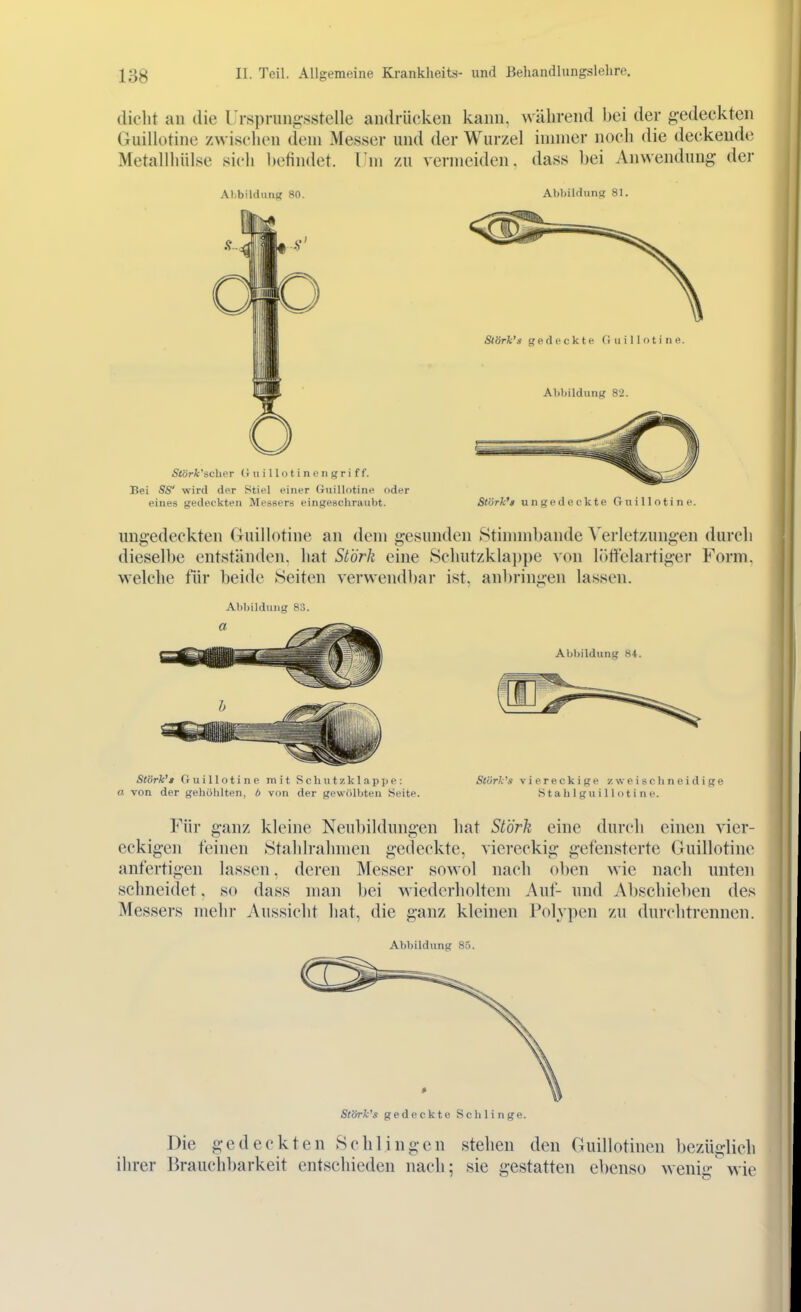 dicht an die l'rsprungsstelle andrücken kann, während bei der gedeckten Guillotine zwischen dem Messer und der Wurzel innner noch die deckende Metallhülse sich befindet, l iii zu vermeiden, dass bei Anwendung der Alibildung 80. Abbildung 81. eines gedeckten Messers eingeschraubt. Störk't ungedeckte Guillotine. ungedeckten Guillotine an dem gesunden Stiniinbande Verletzungen durch dieselbe entständen, hat Stork eine 8chutzkla))])e von löftclartiger Form, welche für beide leiten verwendbar ist, anbringen lassen. Abbildung 8:;. Stork'» Guillotine mit Scbutzk 1 ap]>e: Störk's viereckige zweischneidige a. von der gehöhlten, 6 von der gewölbten Seite. S t a b 1 g u i 11 o t i n e. Für ganz kleine Neubildungen hat Stork eine durch einen vier- eckigen feinen Stahlrahmen gedeckte, viereckig gefensterte Guillotine anfertigen lassen, deren Messer sowol nach oben wie nach unten schneidet. so dass man bei wiederholtem Auf- und Abschieben des Messers mehr Aussicht liat, die ganz kleinen Polypen zu durchtrennen. Abbildung 85. St'örk's gedeckte Schlinge. Die gedeckten Schlingen stehen den Guillotinen bezüglich ihrer Brauchl)arkeit entschieden nach; sie gestatten e])enso wenig wie